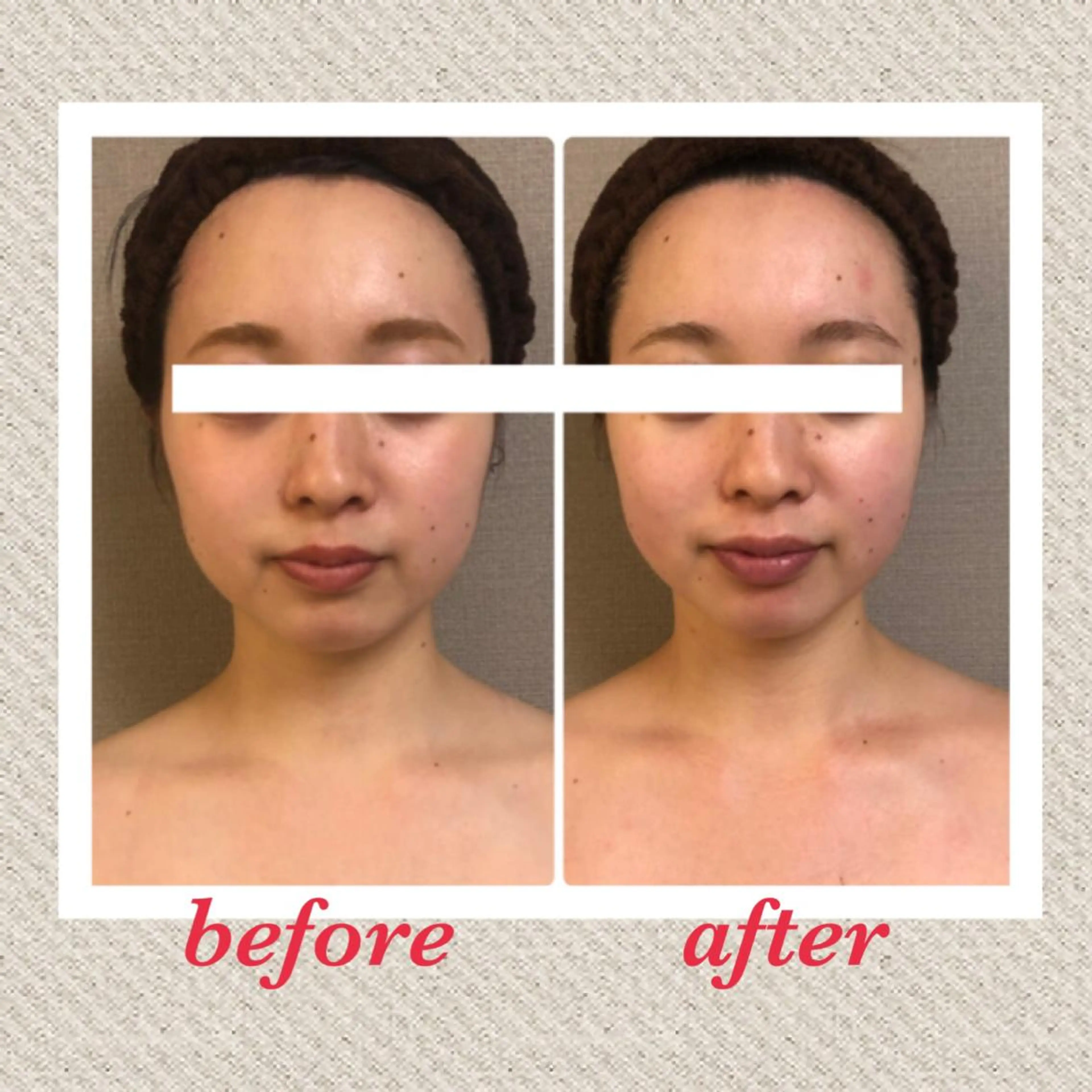 エステ 美ola ビオラのエステ・リラクイメージ