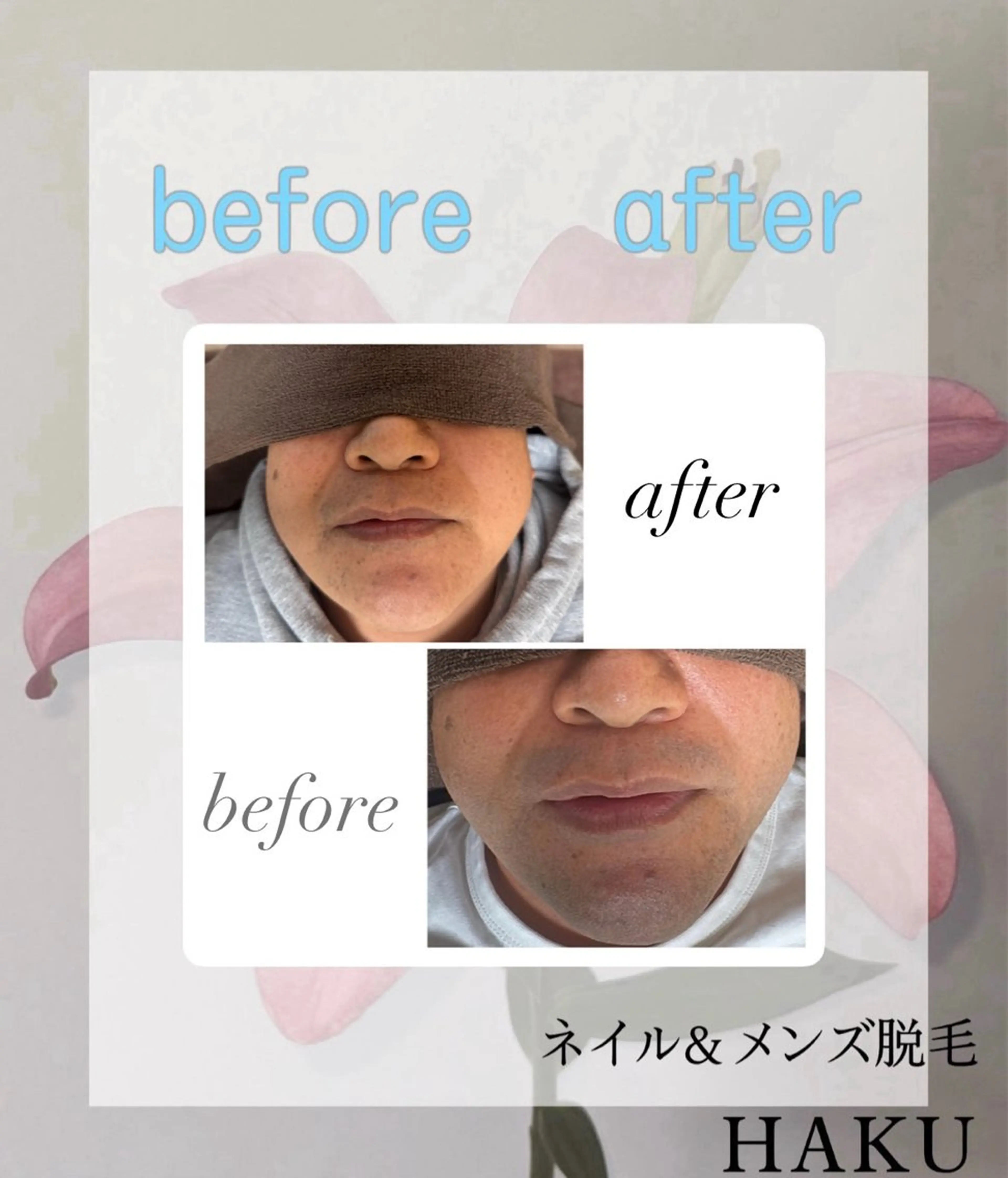 メンズ 脱毛 菊池 雪乃のエステ・リラクイメージ