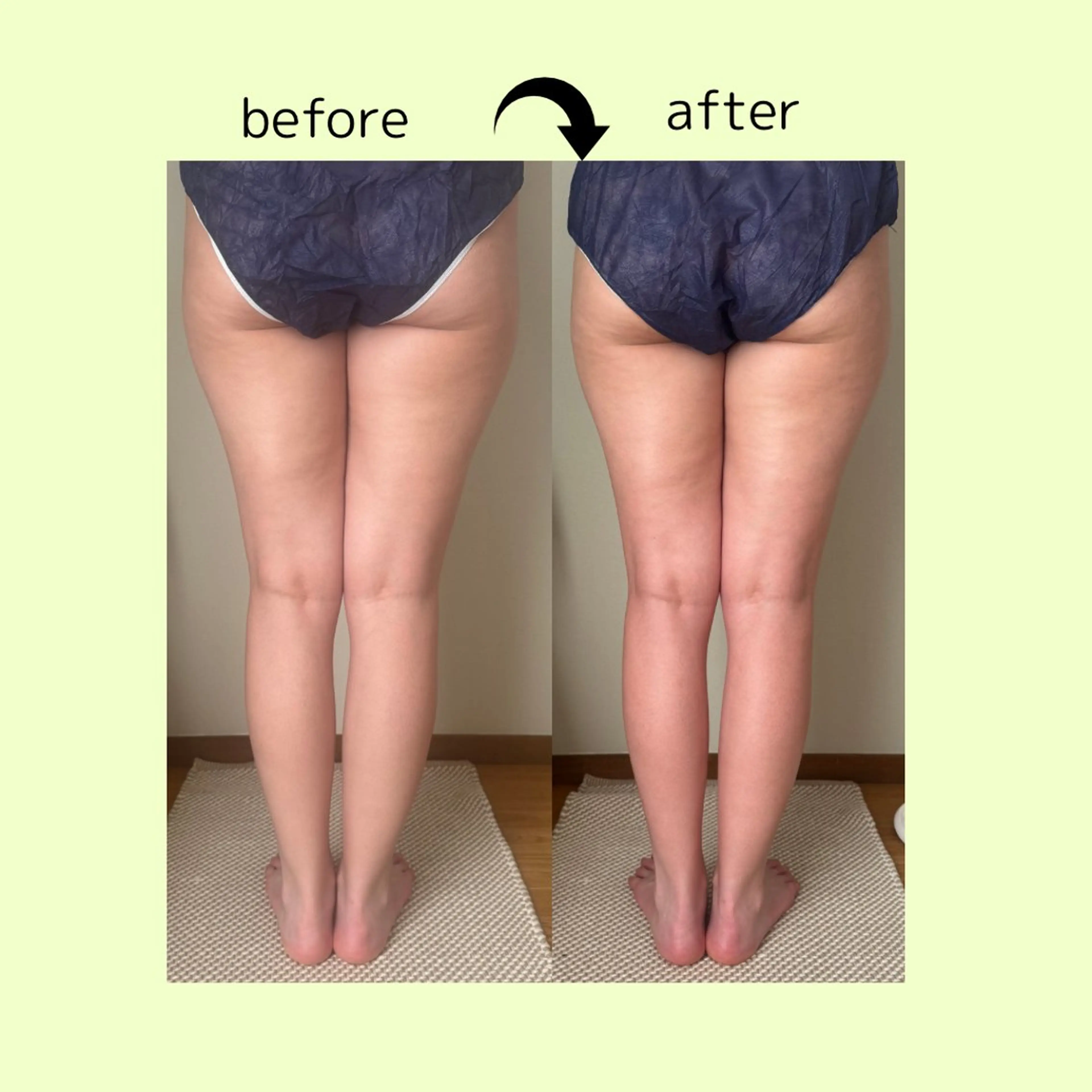 リラクゼーションスパ　ひのき所属・spaHINOKI 【女性専用】のエステ・リラクイメージ