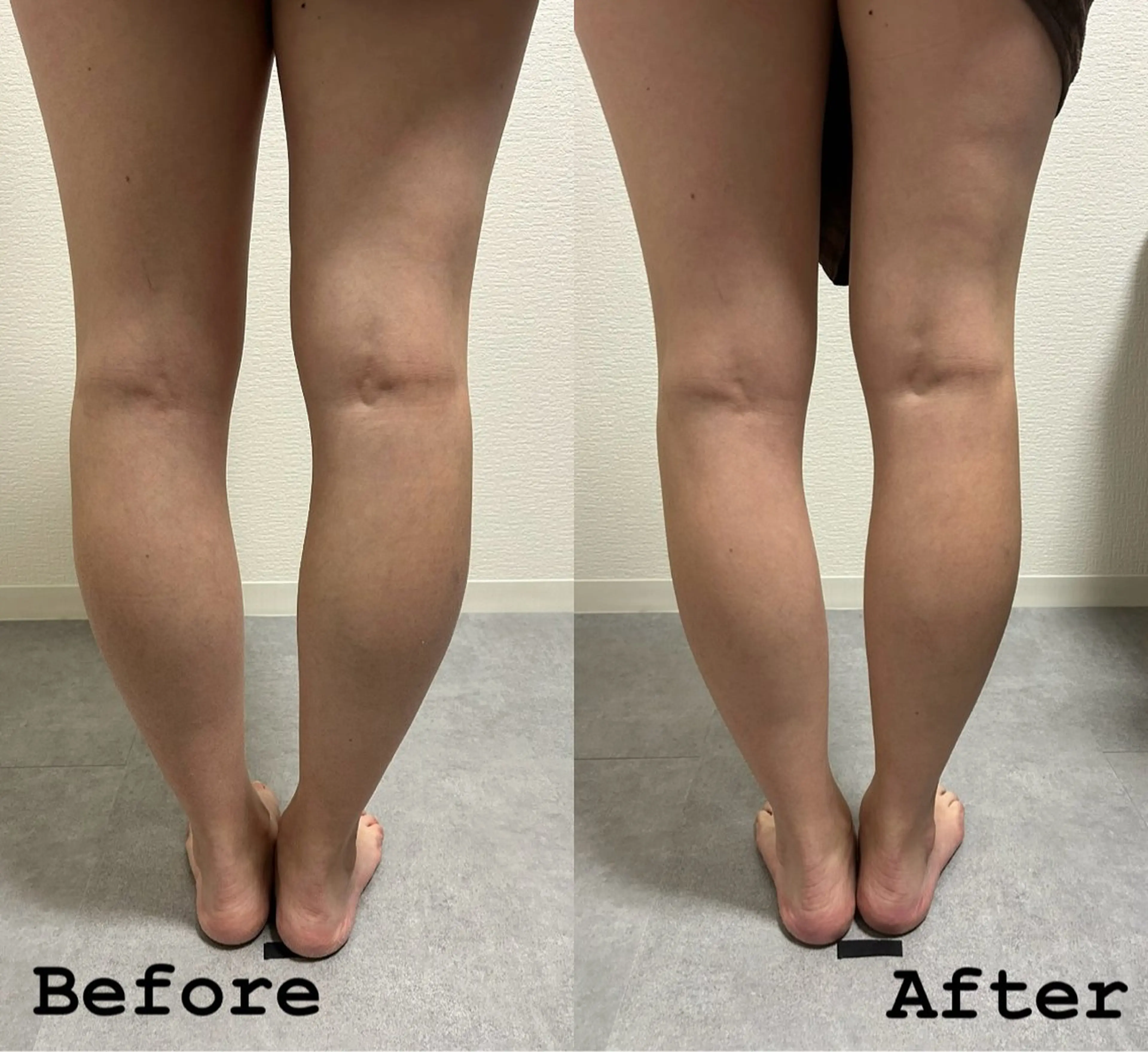 SOIN ボディー リラクゼーションのエステ・リラクイメージ