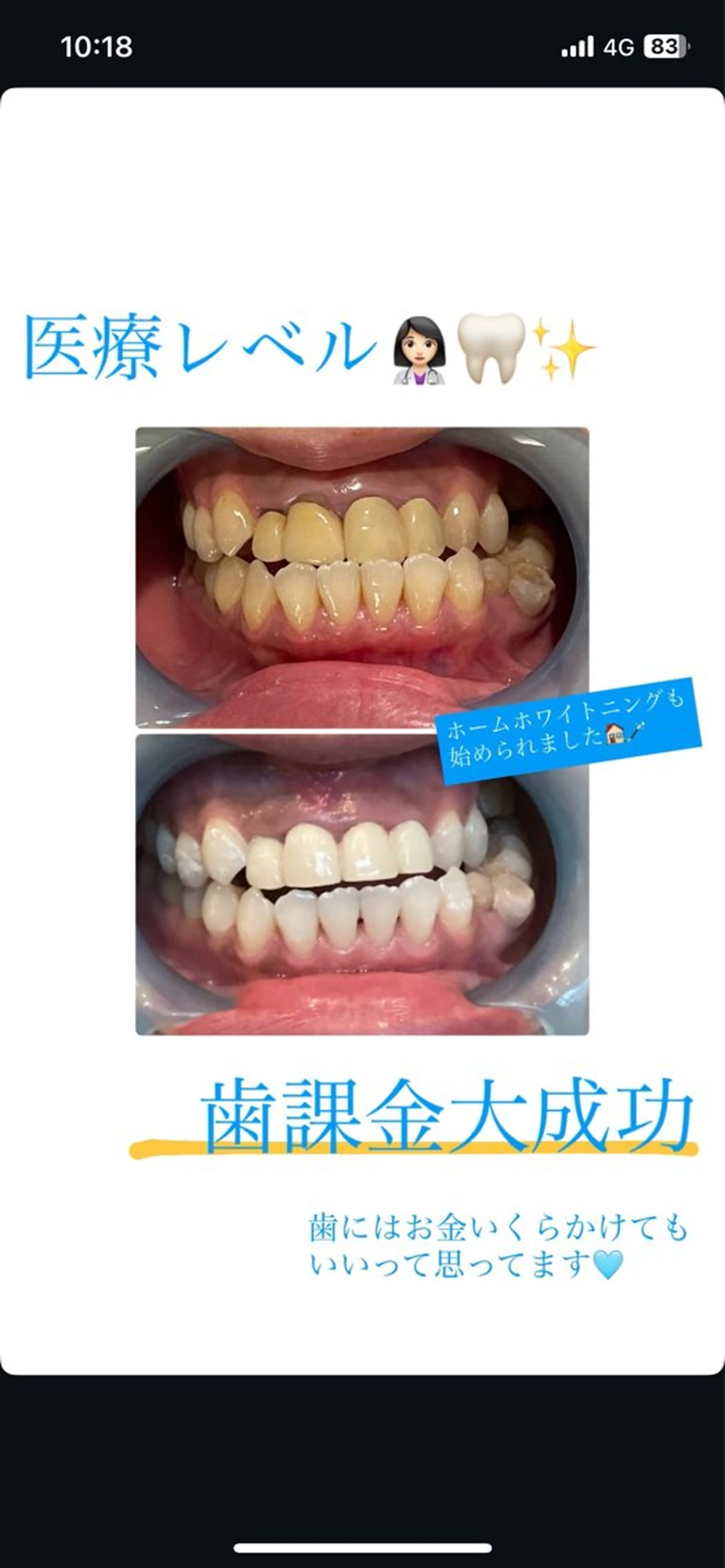 Monreve所属・美人スイッチdiet スーパージェクションのその他イメージ