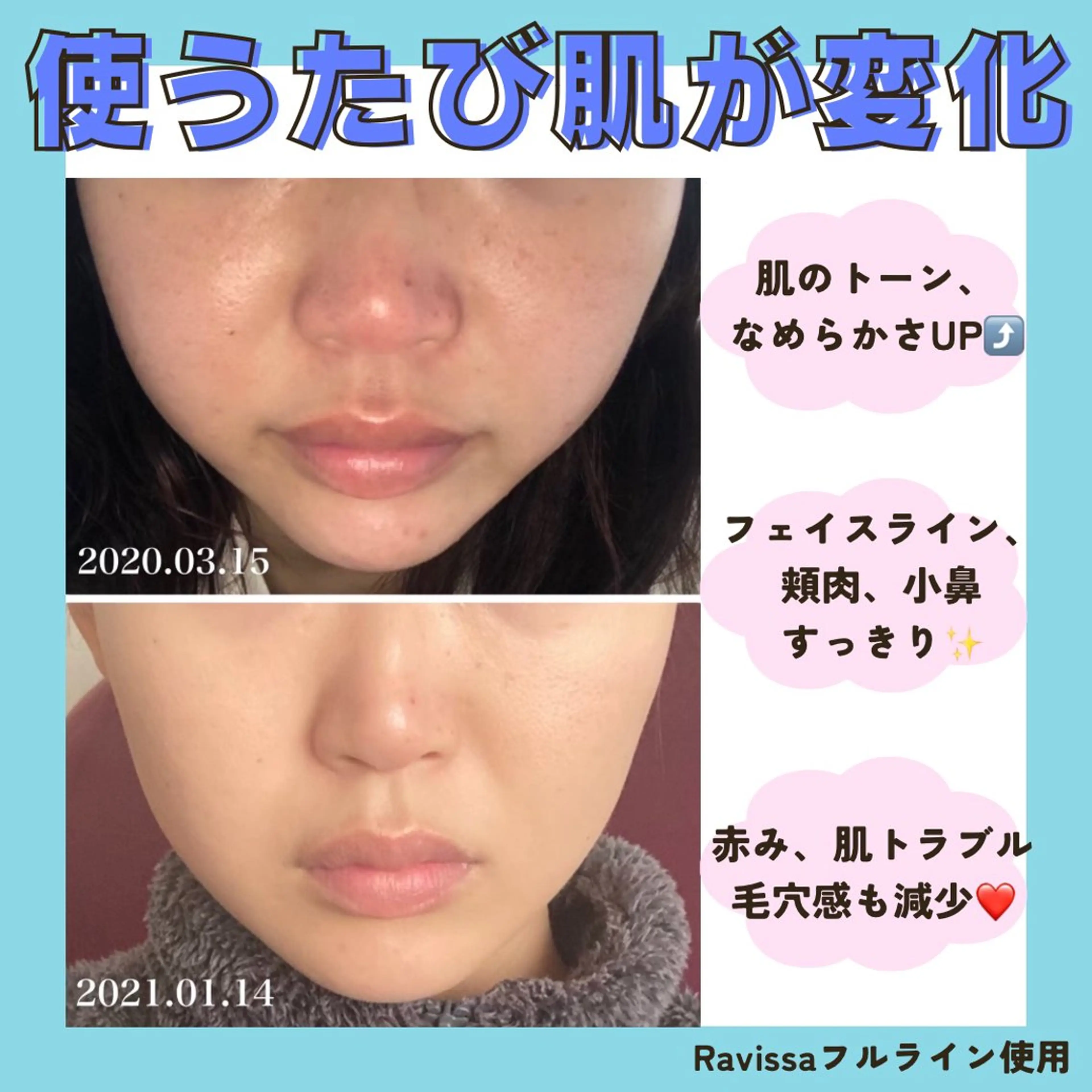 【ホームケア・スキンケアアドバイス】 💎美肌効果が高く、お肌の土台から整え透明感がUP⤴︎するラヴィーサ化粧品使用🌸の写真