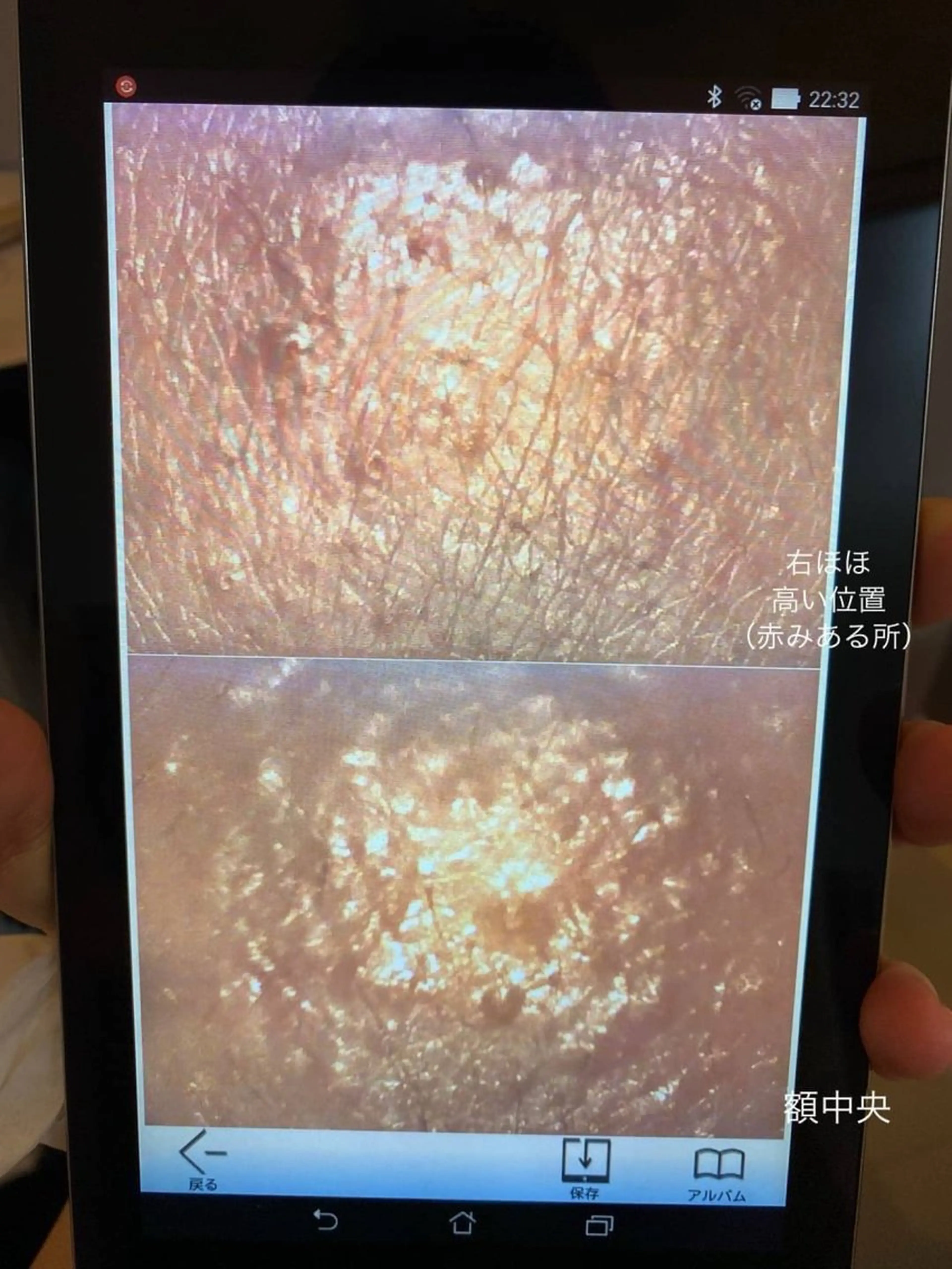 DeI'm 京橋所属・肌質改善サロン AMIのエステ・リラクイメージ