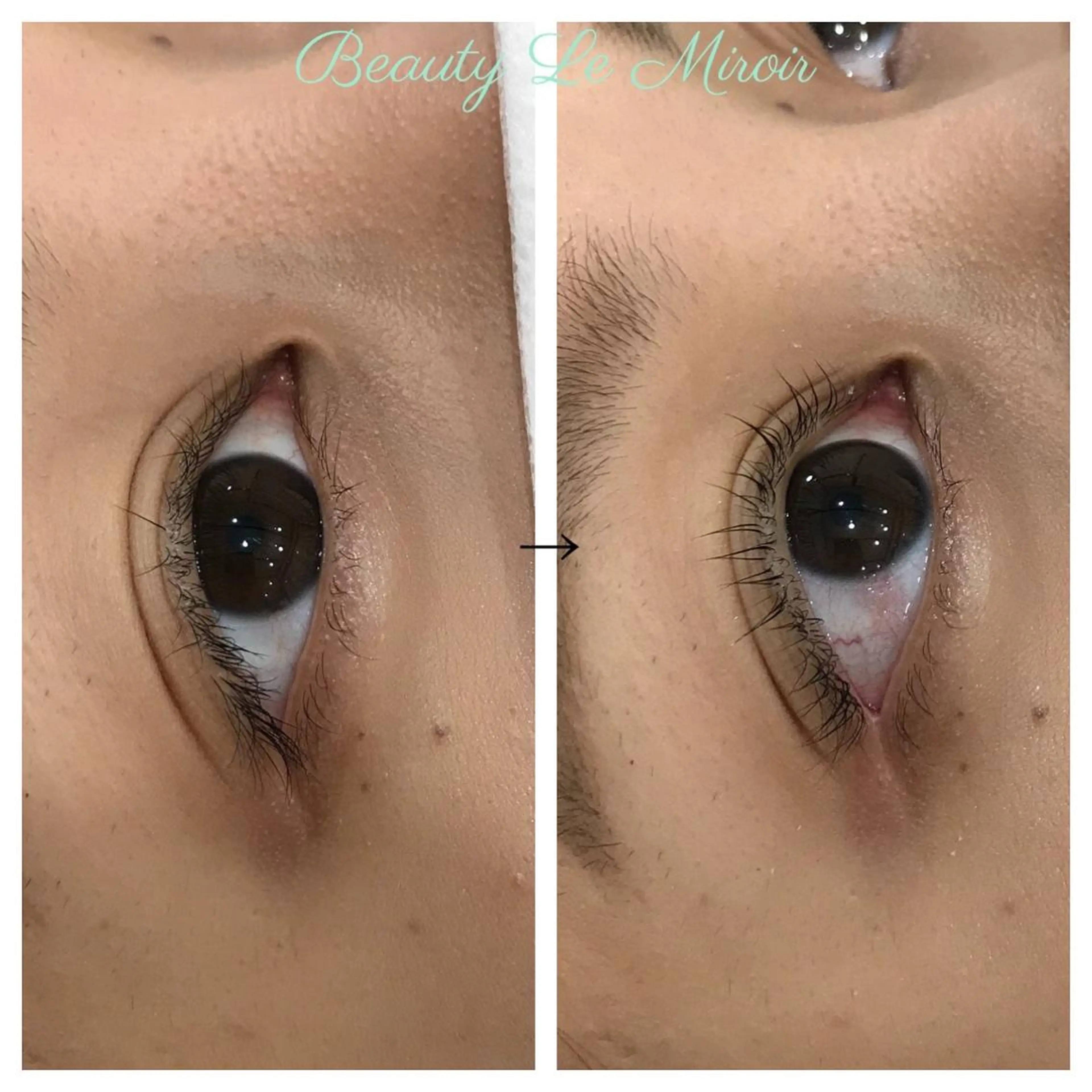 マツエク・マツパ ビューティー ミロワールのエステ・リラクイメージ