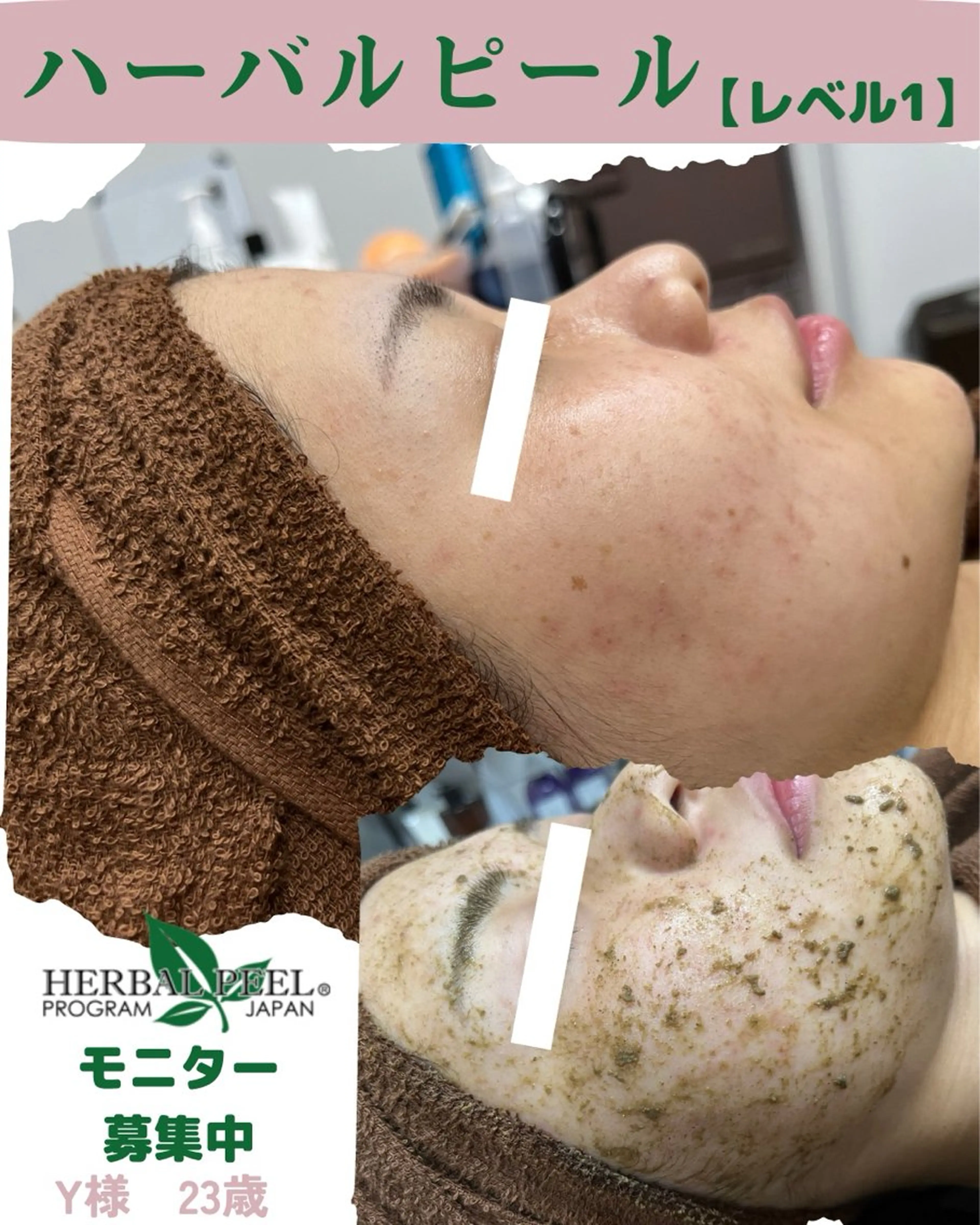 For  Seeds所属・For Seedsのエステ・リラクイメージ