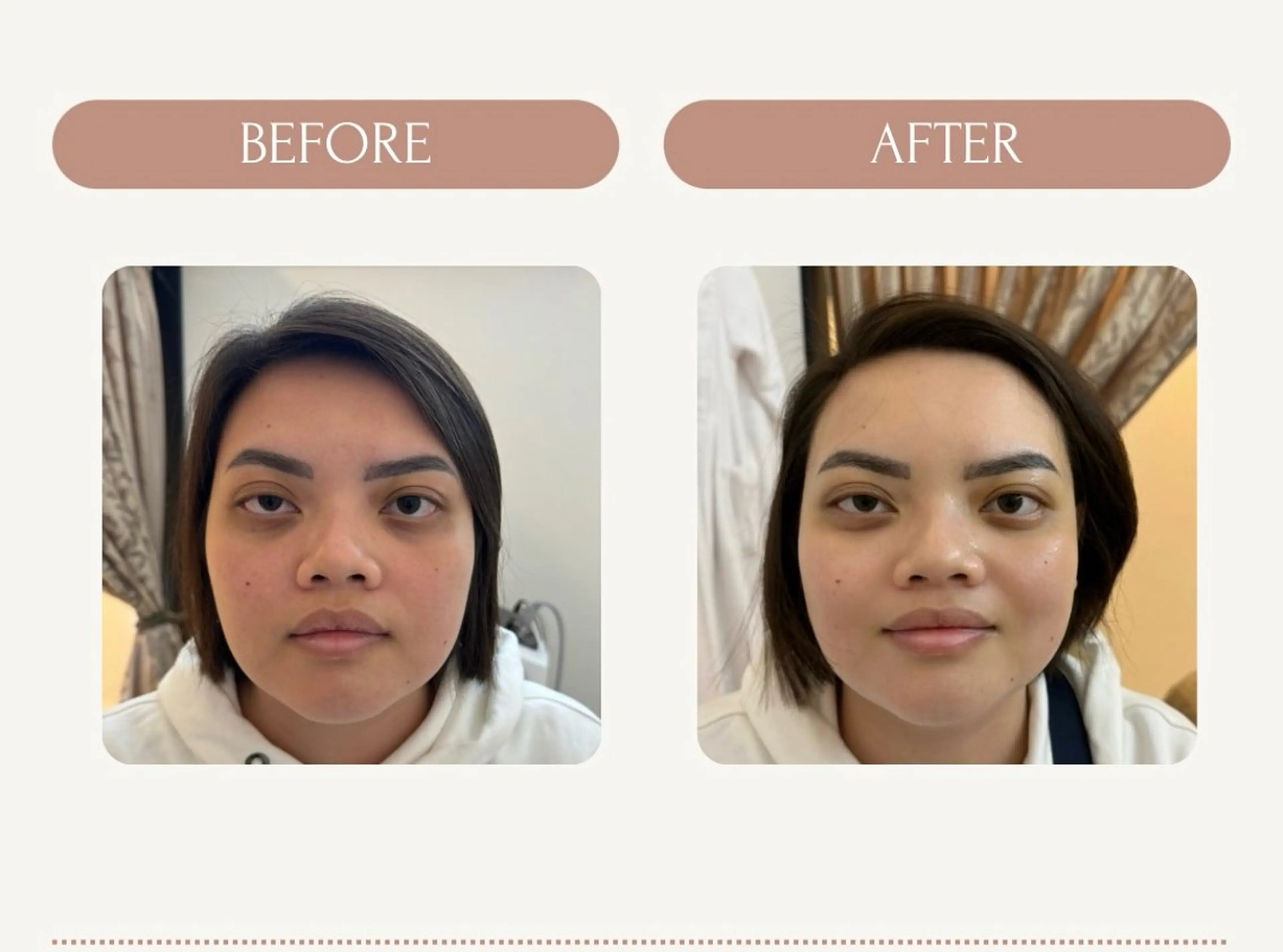 【福岡市西区 エステ】 GRANVIR(グランヴィール)所属・GRANVIR グランヴィールのエステ・リラクイメージ