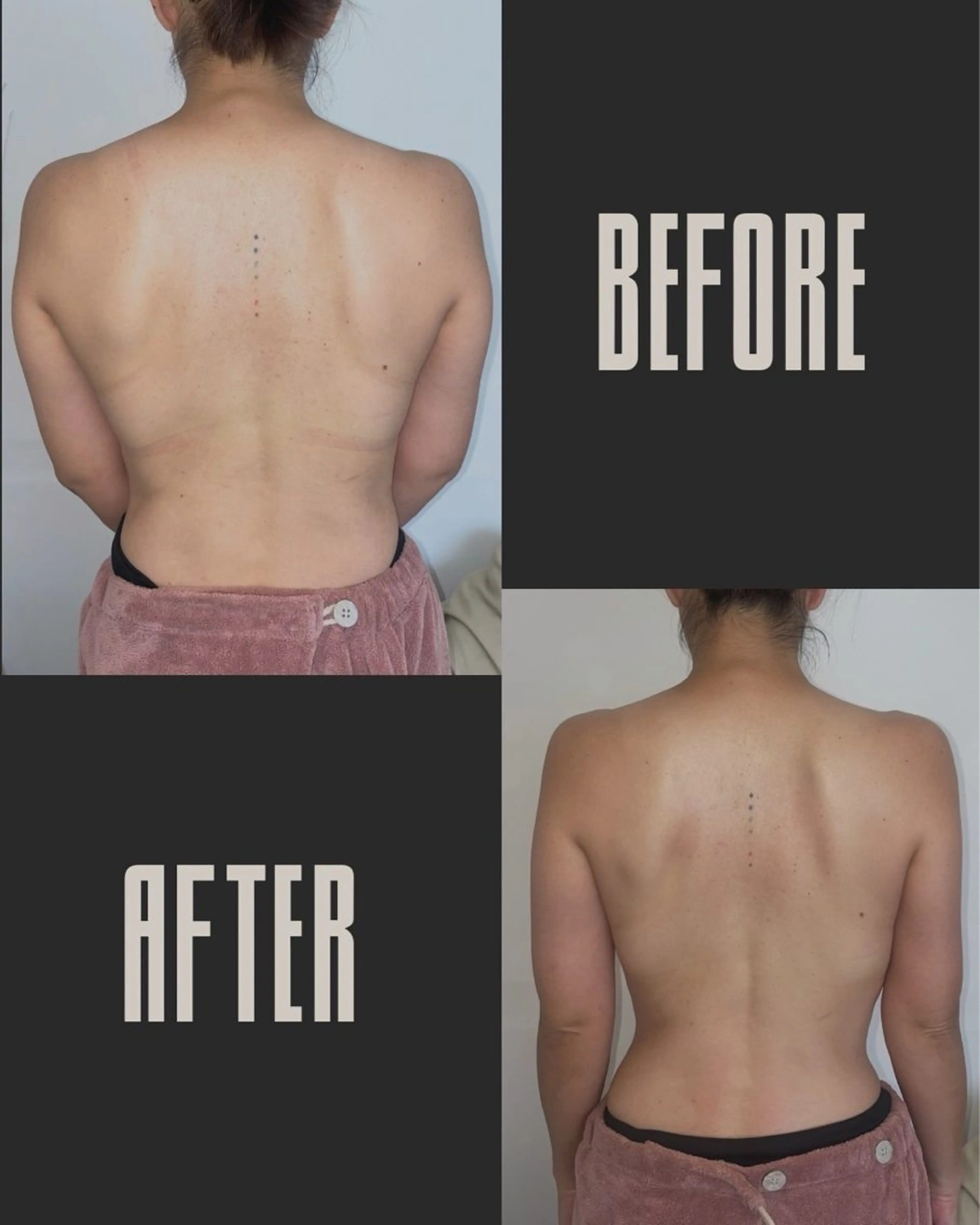 【選べる】上or下半身スッキリ✨お試しオールハンド痩身エステ💆‍♀️🌿の写真