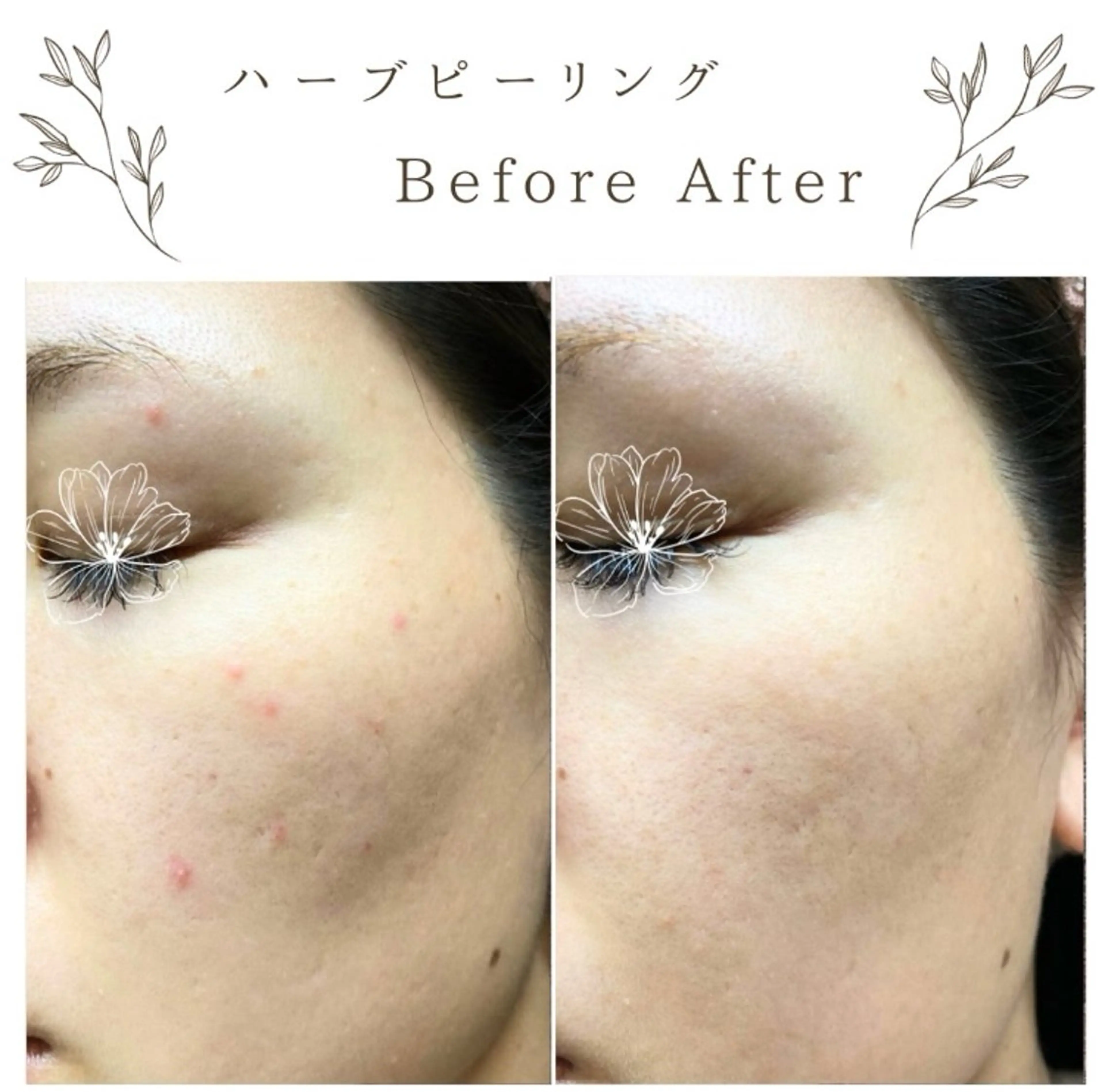 な ぎのエステ・リラクイメージ