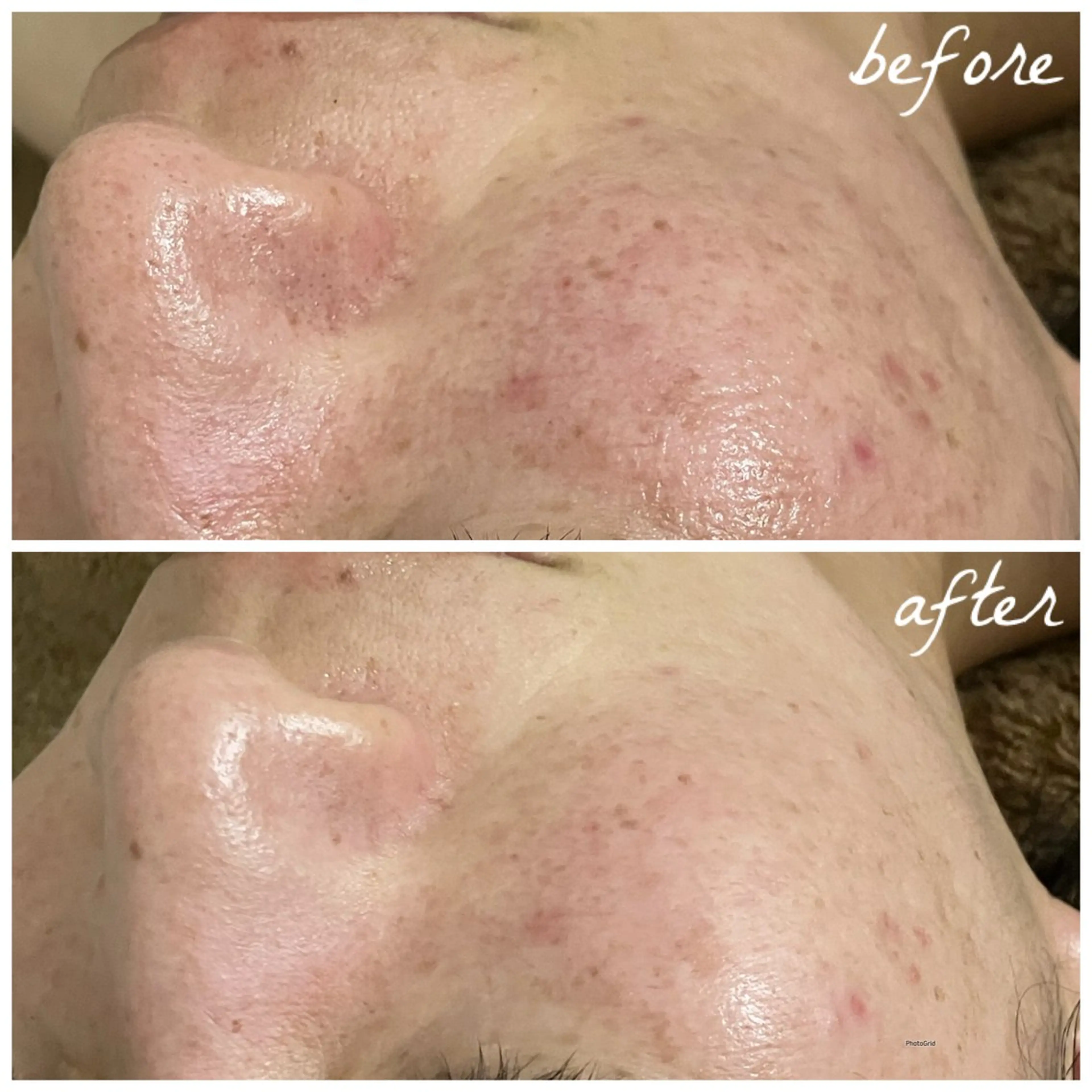 メンズ エステ メナード岐阜茜部 杉浦のエステ・リラクイメージ