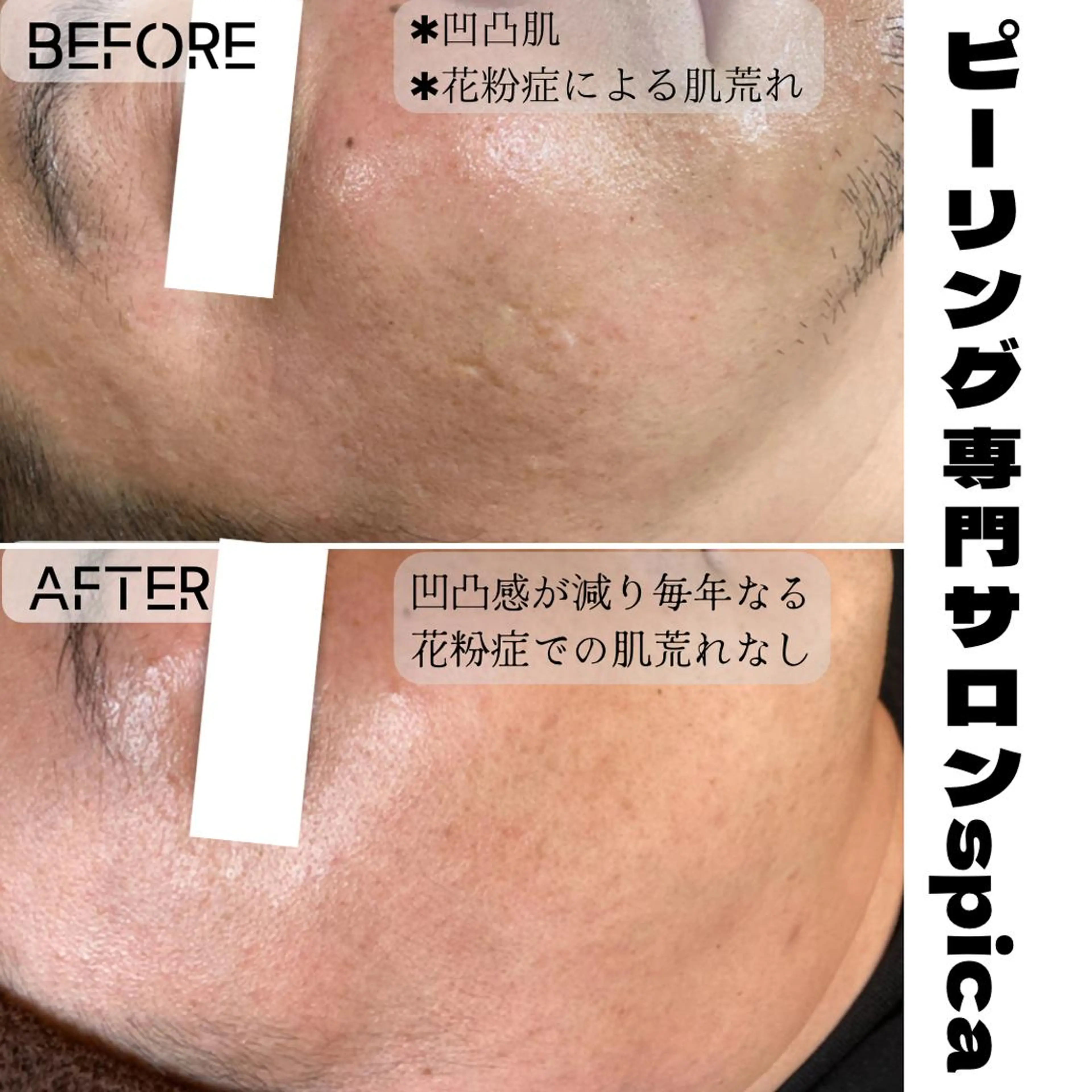 エステ ピーリング専門サロン Spicaのエステ・リラクイメージ