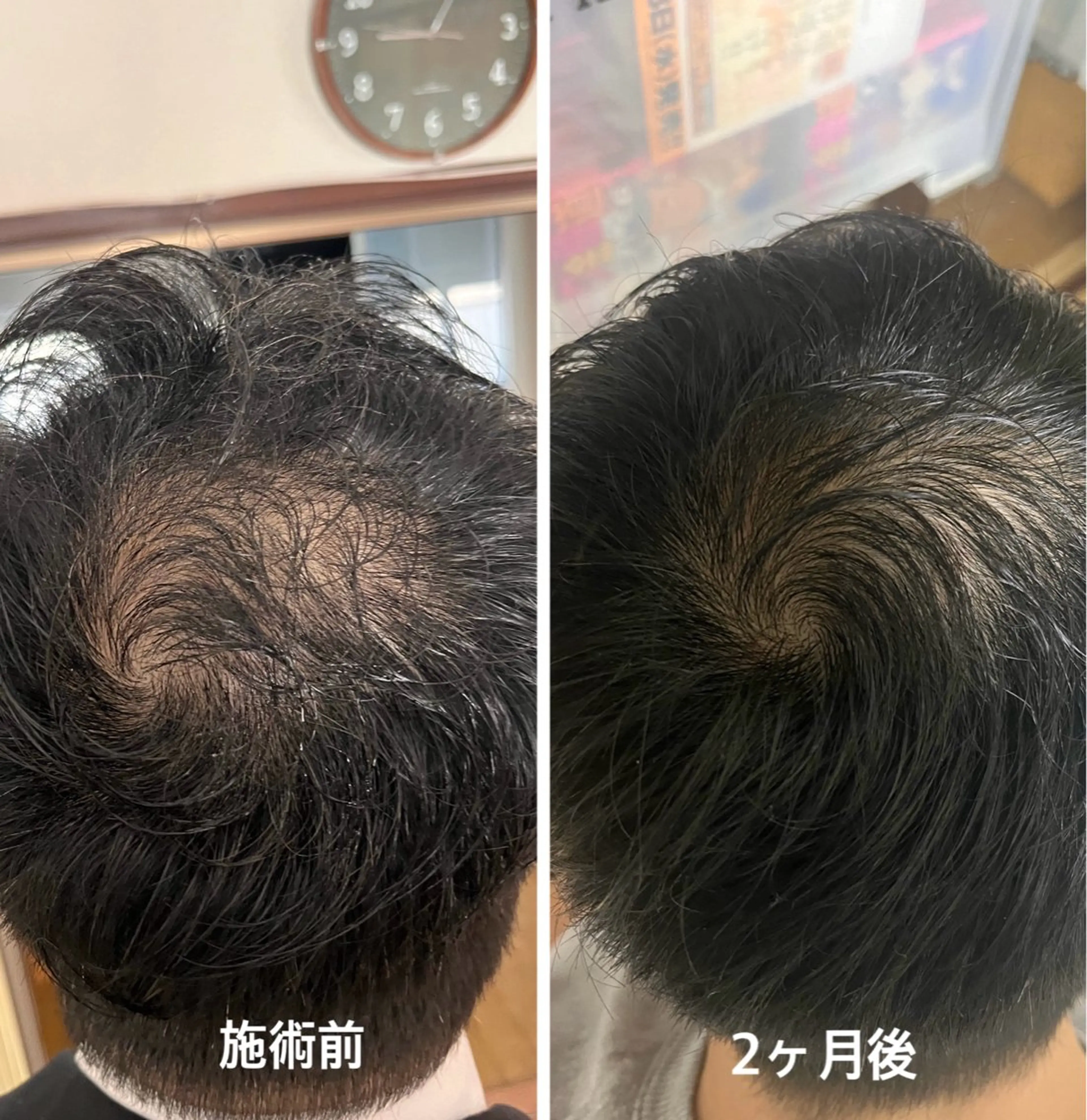 天使のしずく 神戸店所属・幹細胞エクソソーム 専門店 天使のしずくのその他イメージ