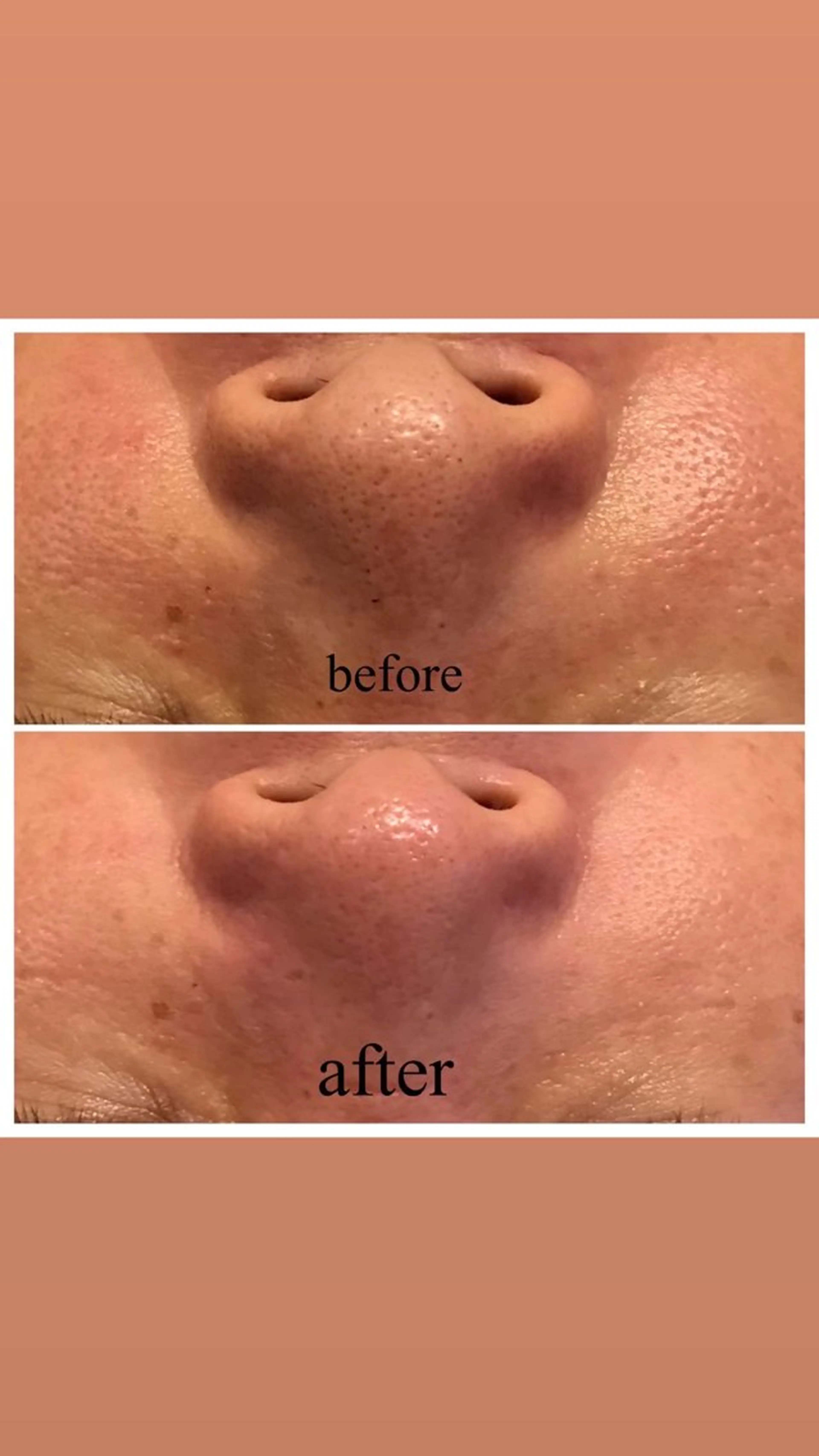 Monreve所属・美人スイッチdiet スーパージェクションのその他イメージ