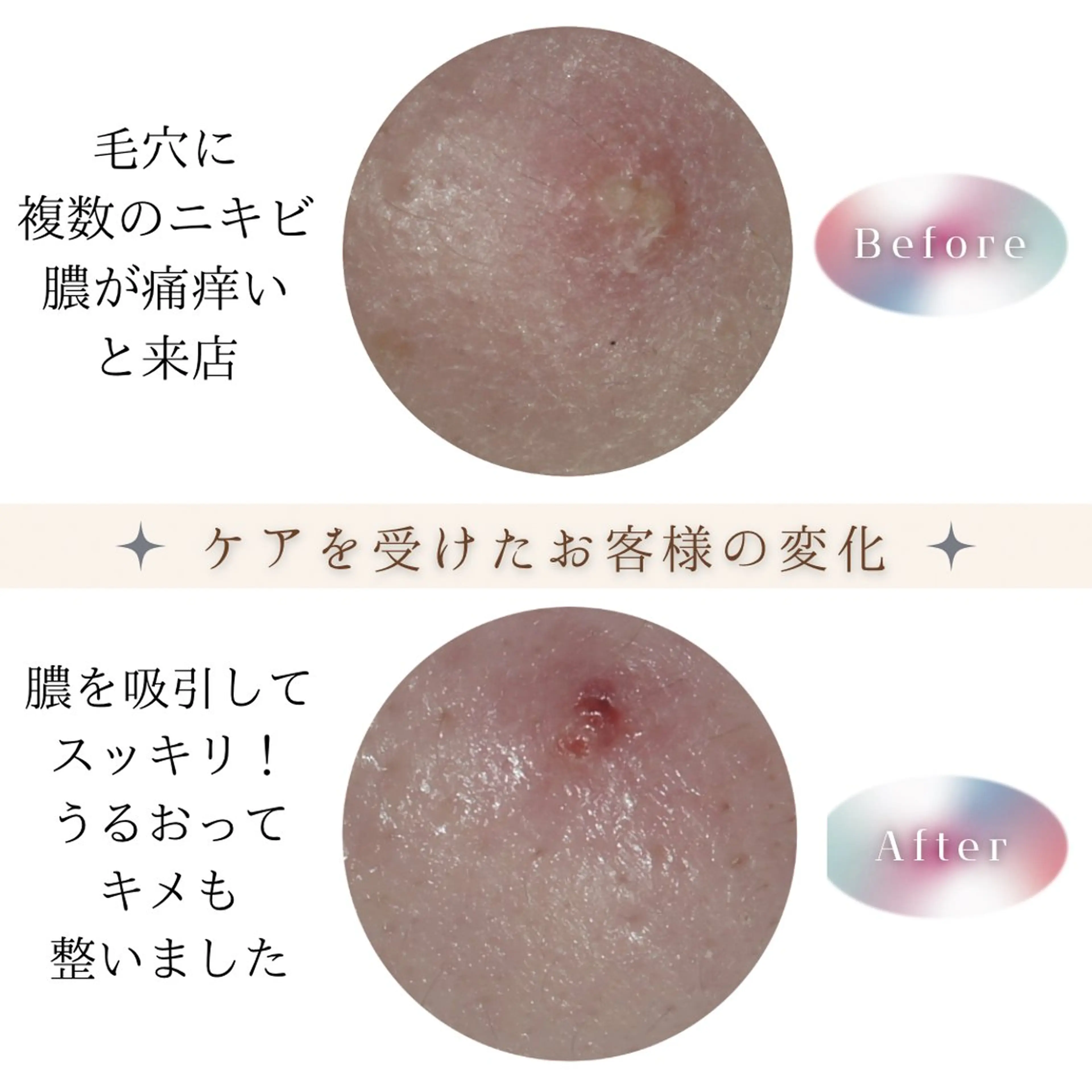 メンズ ネイル エステ リラク 浜松よもぎ蒸し/温活 /メナード認定サロンのエステ・リラクイメージ