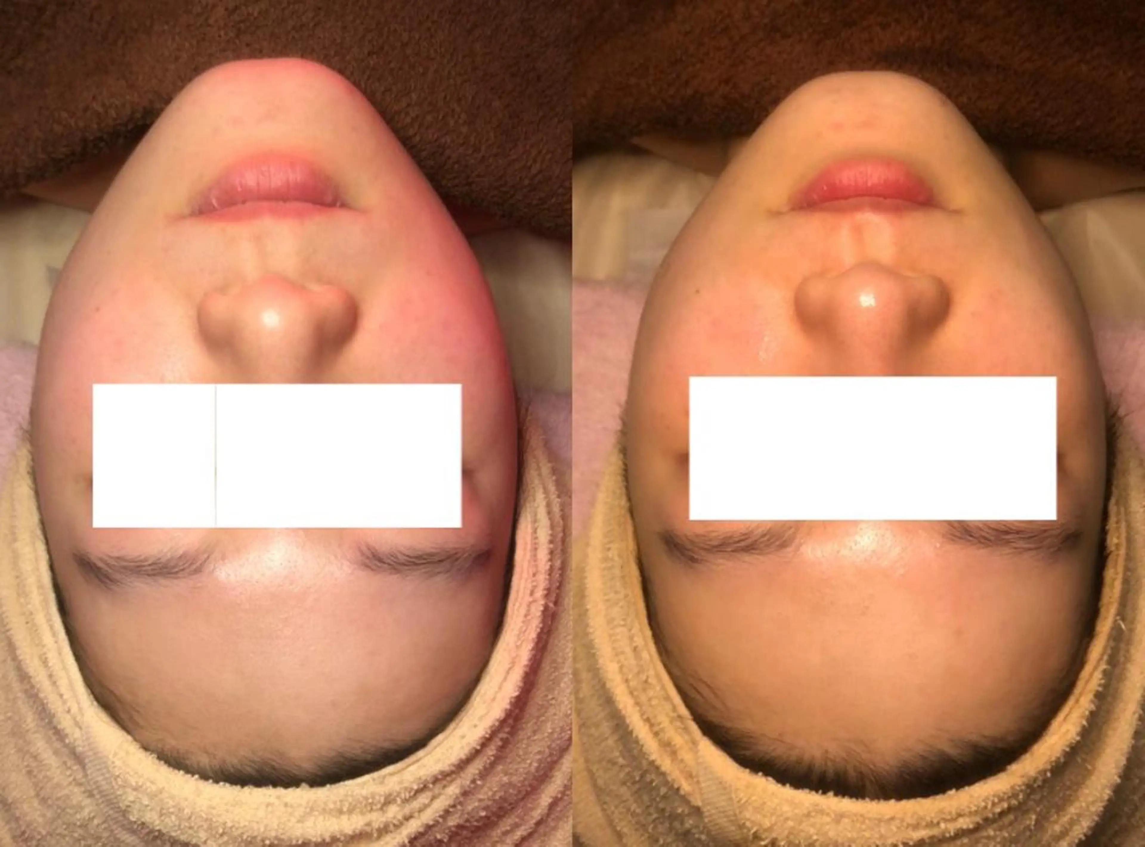 a  room salonのエステ・リラクイメージ