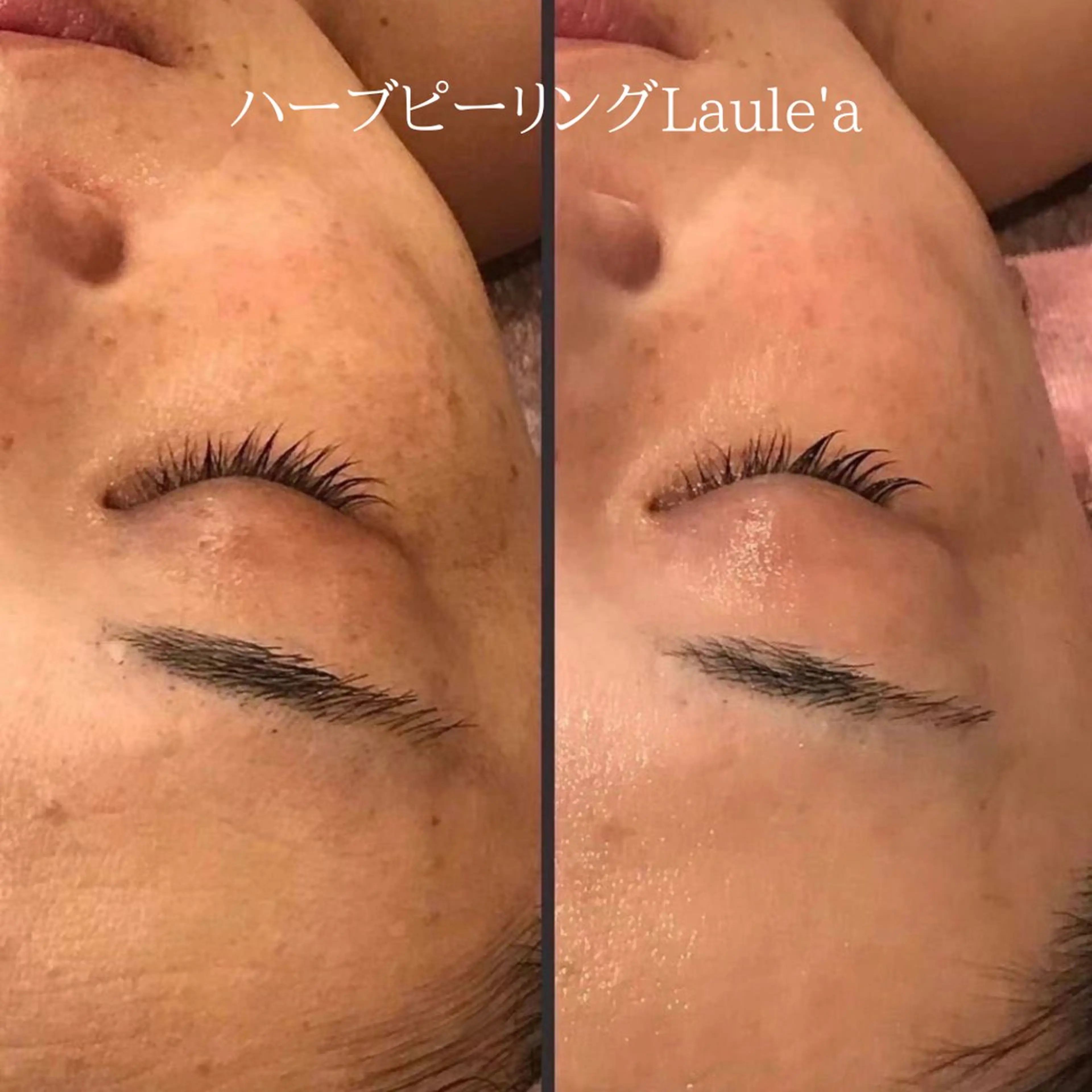 美腸サロン🌺 腸もみ/小顔/リンパのエステ・リラクイメージ