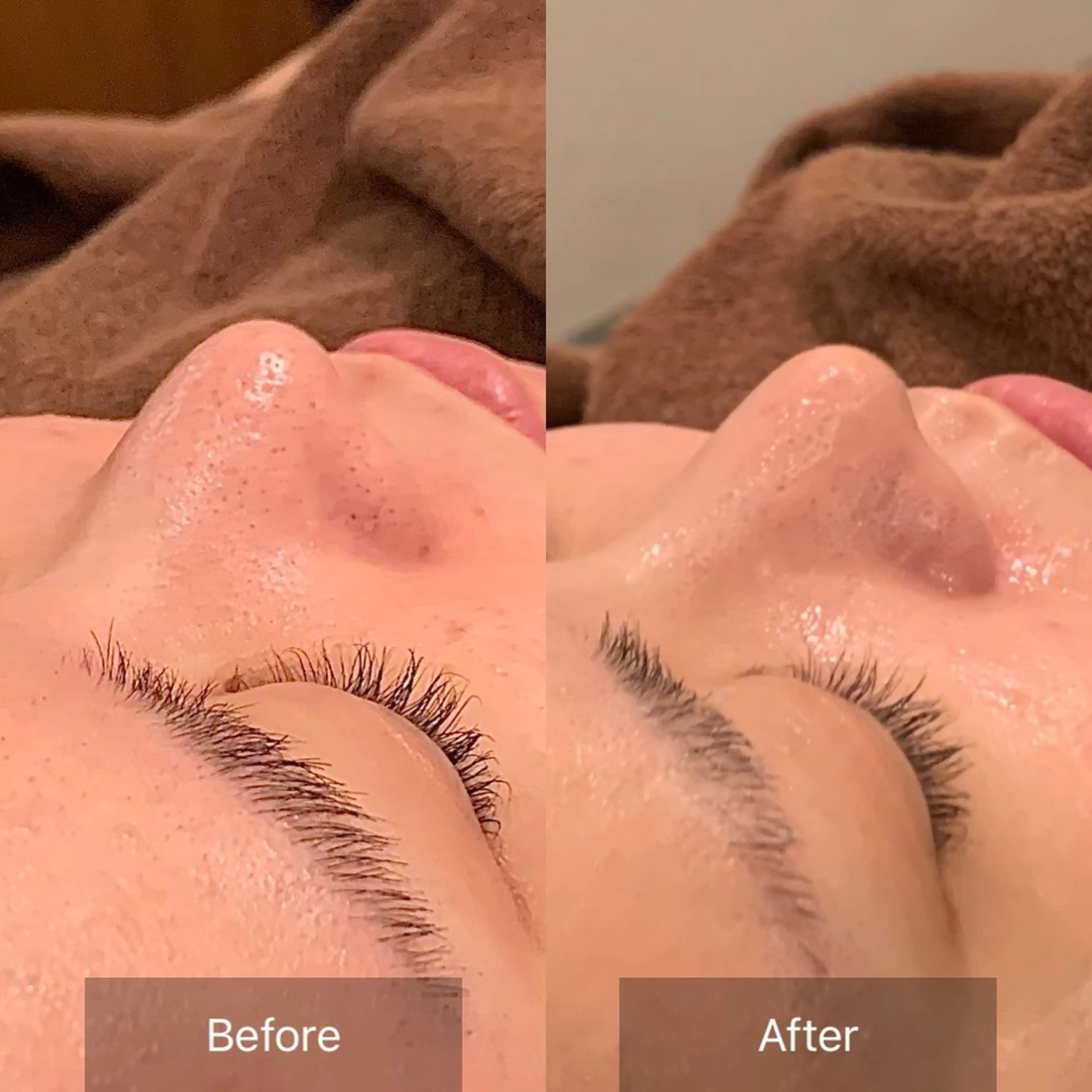 渋谷ベルゼ🌷木下 毛穴/脱毛/フェムのその他イメージ