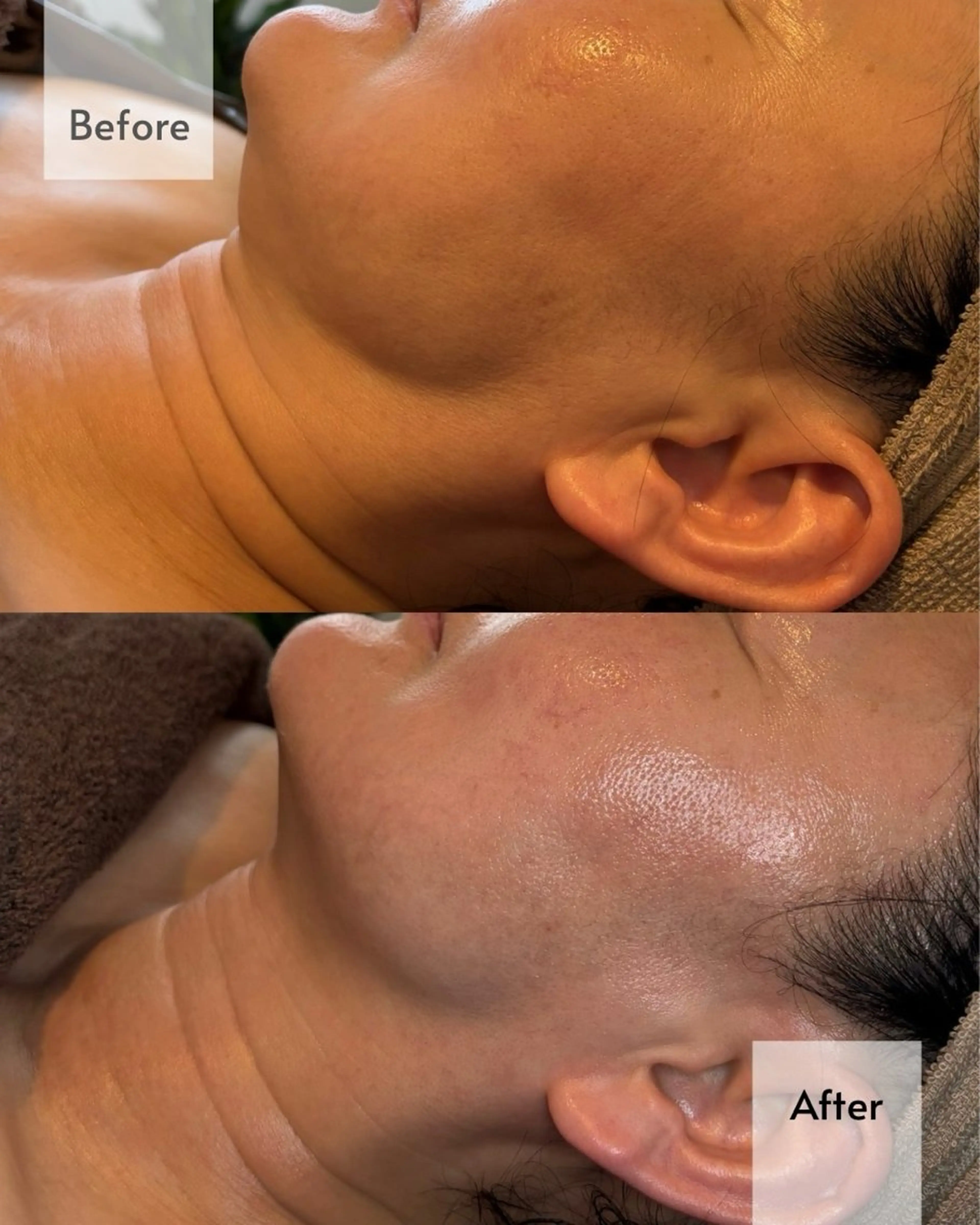 エステ リラク NOAR Risaのエステ・リラクイメージ