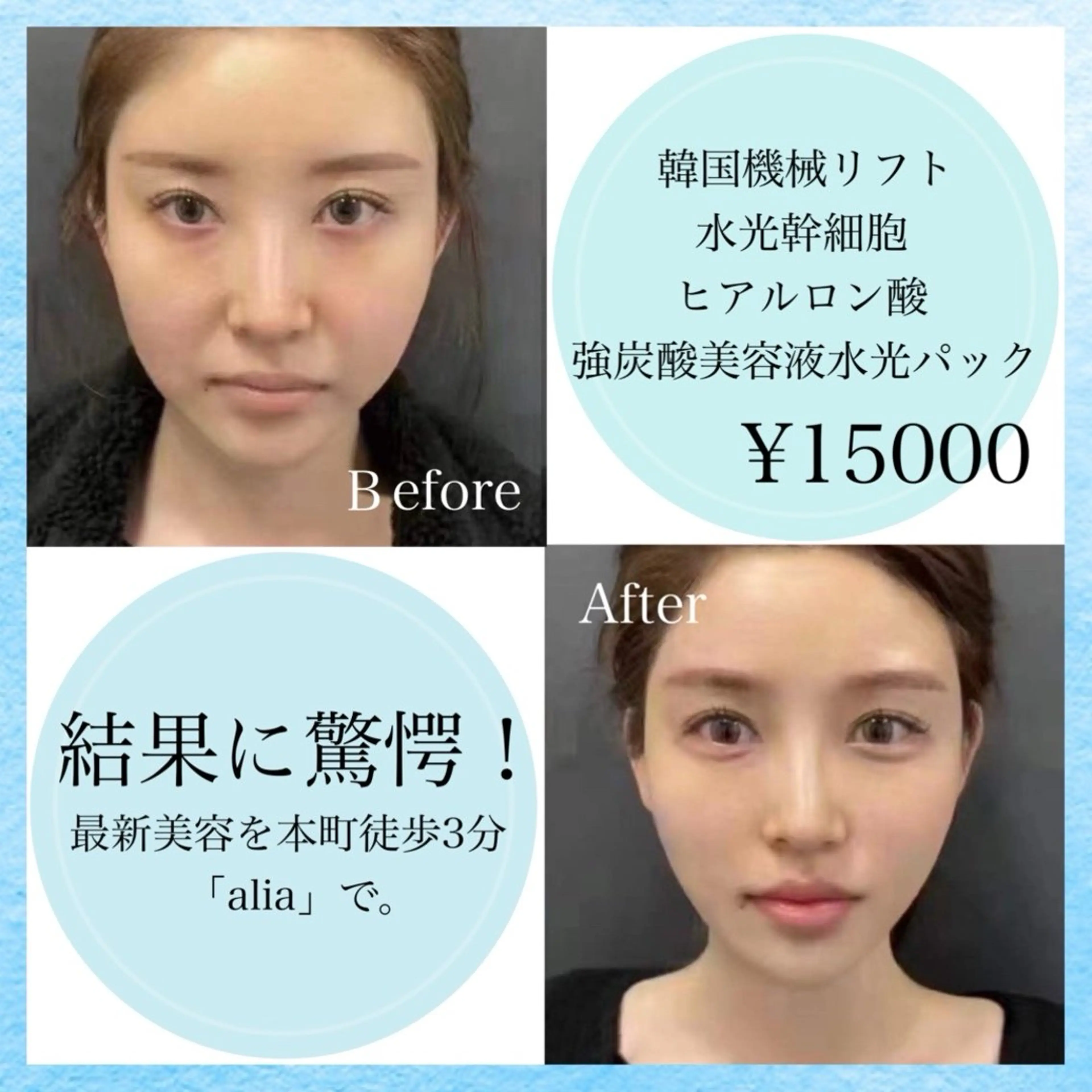 マツエク・マツパ 結婚式・ブライダル エステ aliaハイフ&水光ジェットサロン所属・aliaハーブ水光店 エステティシャン募集のエステ・リラクイメージ