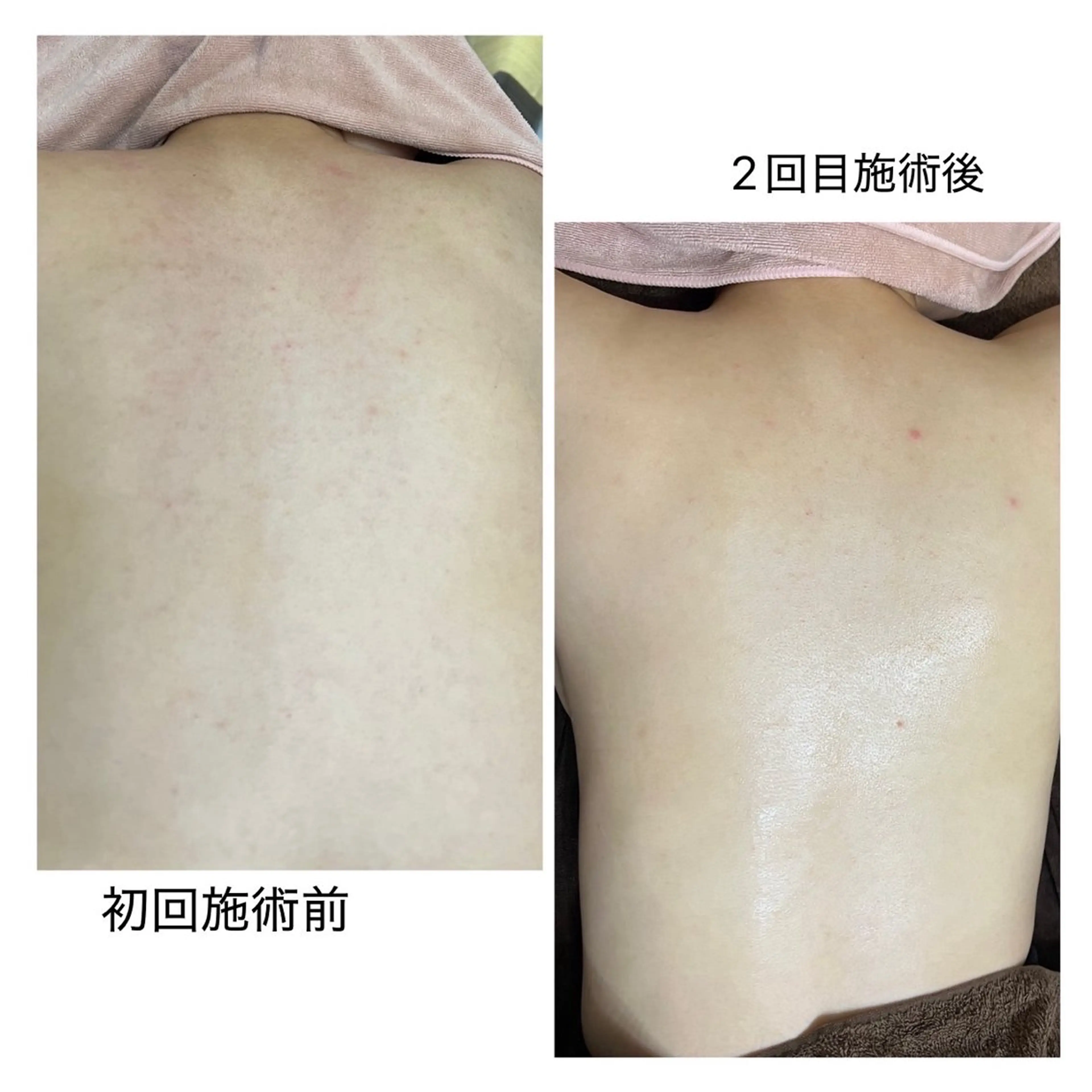 エステ Salon.Rire サロン リルのエステ・リラクイメージ