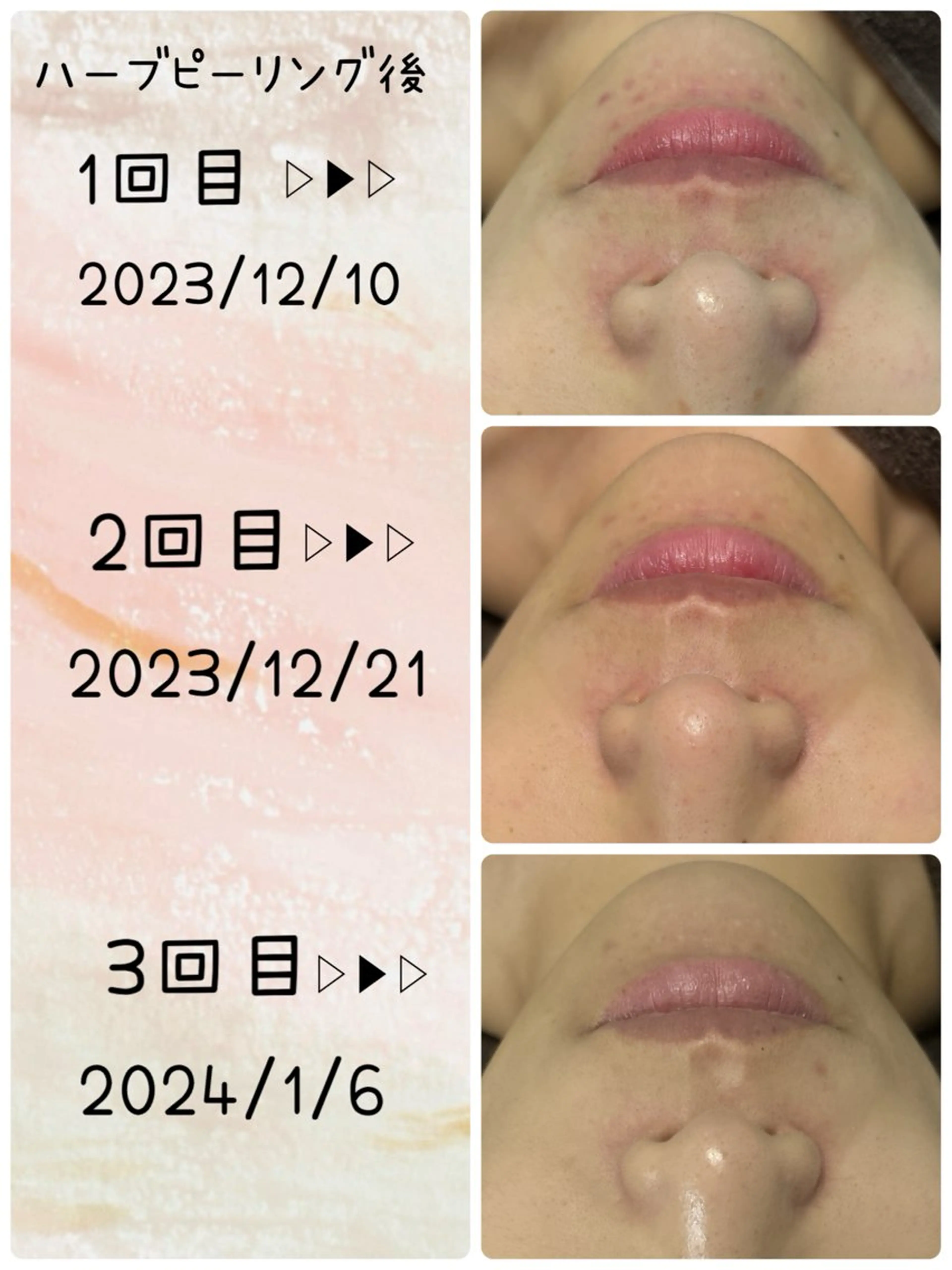 リンパケアサロン 🧡Relairのエステ・リラクイメージ