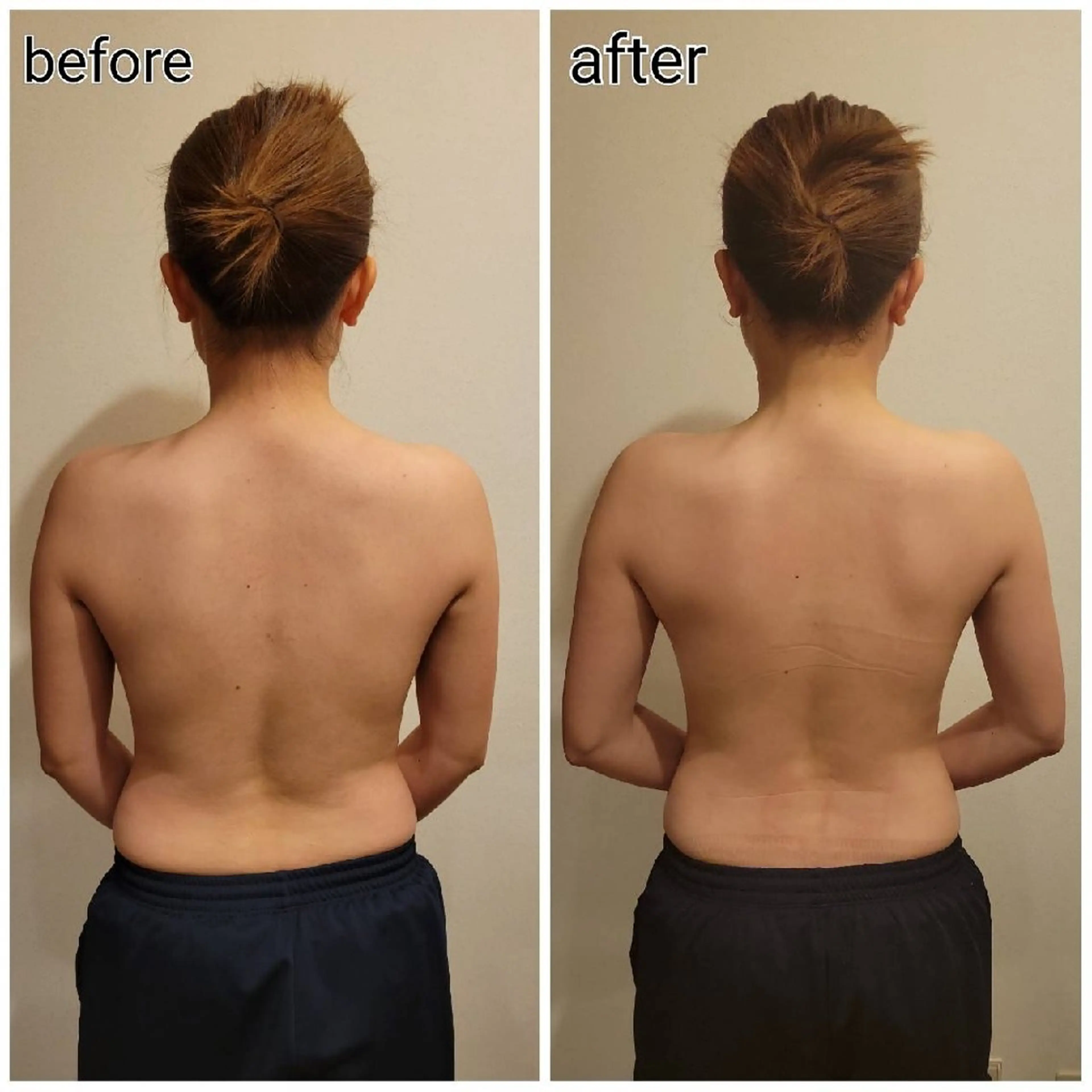 エステ リラク ラジオ波温活エステ✨ yumiのエステ・リラクイメージ