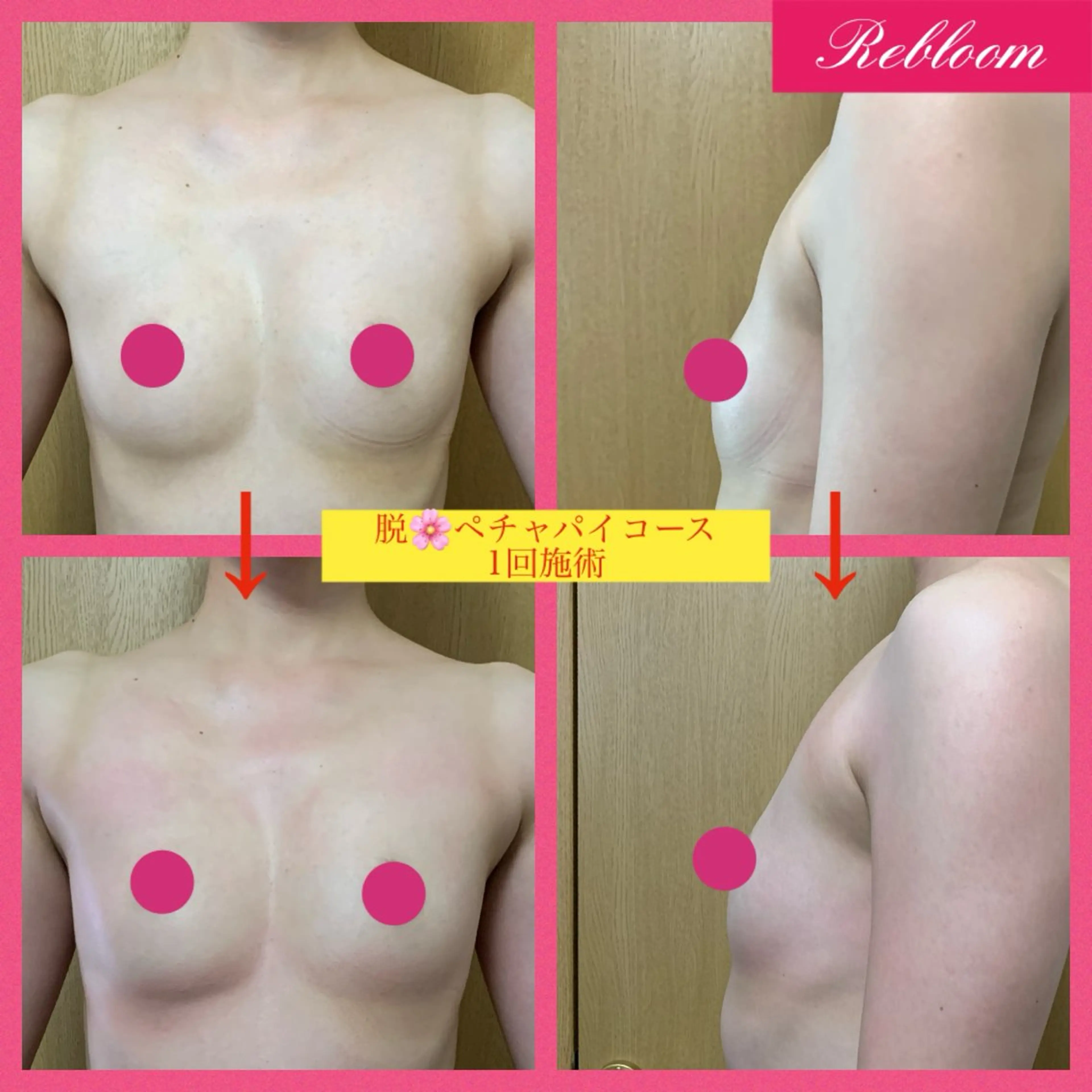 エステ デリケートな悩み解決 Rebloomのエステ・リラクイメージ