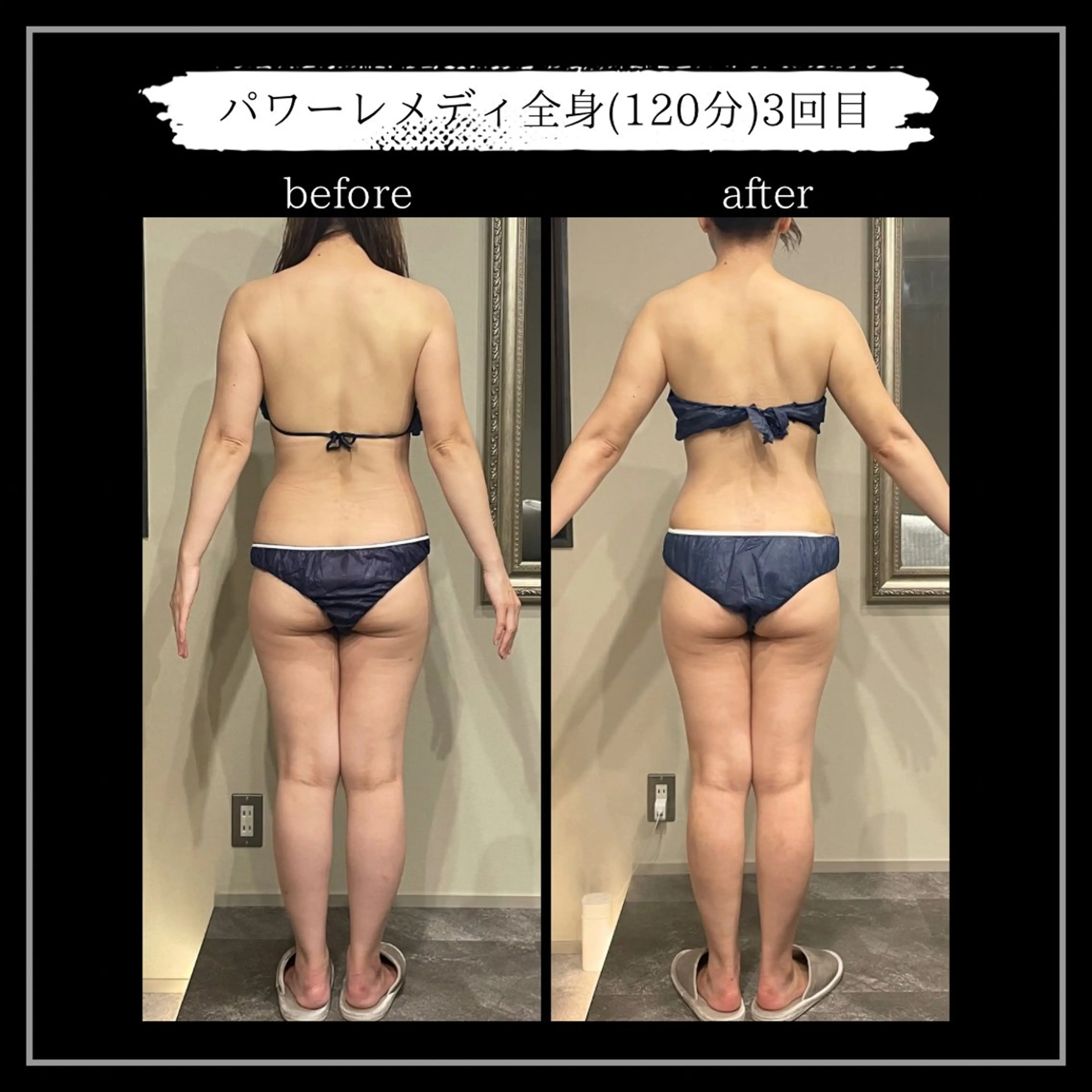 オフ:オン所属・オフ:オン 全身筋膜マッサージのエステ・リラクイメージ