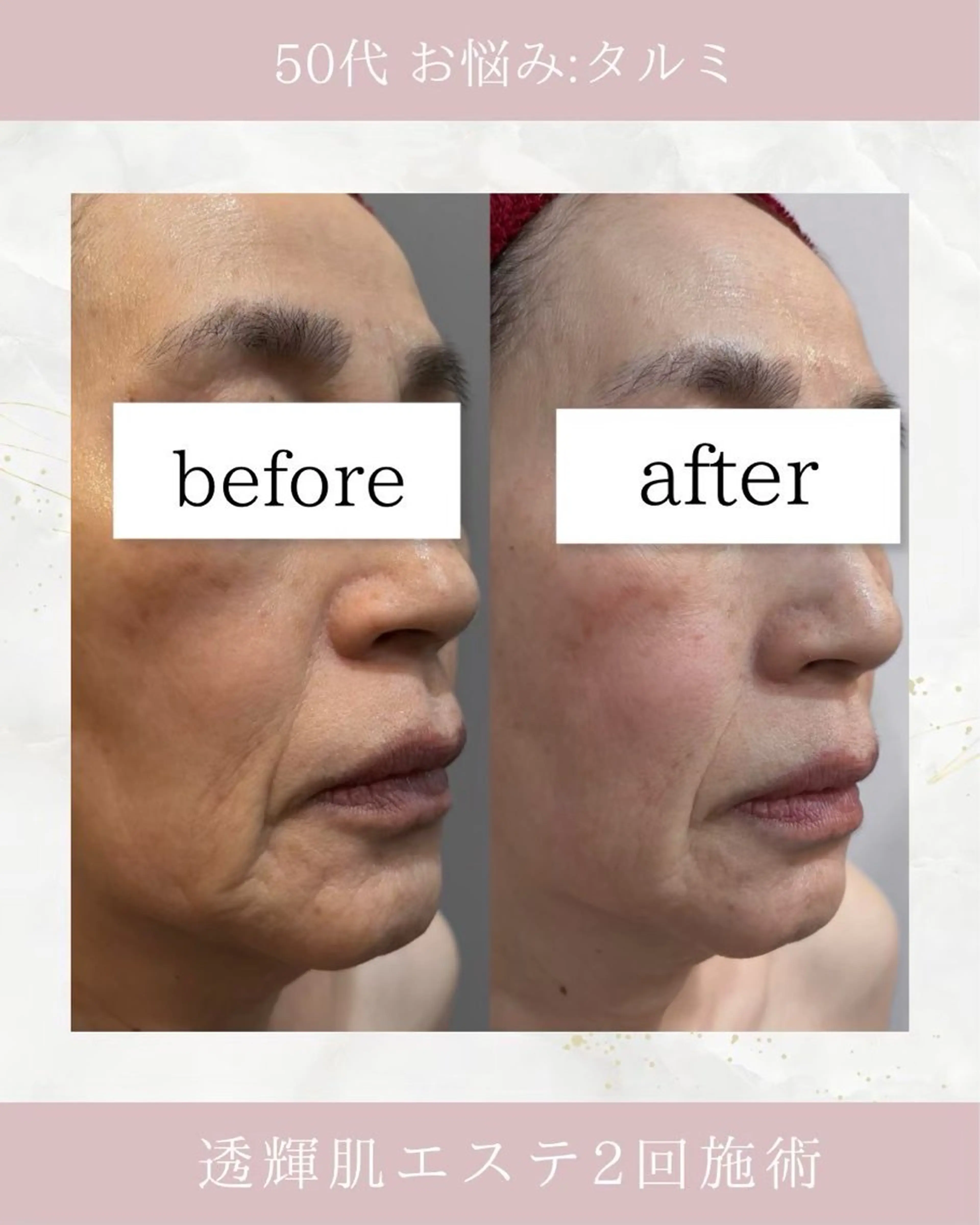 ARuru所属・ARuru 本店のエステ・リラクイメージ