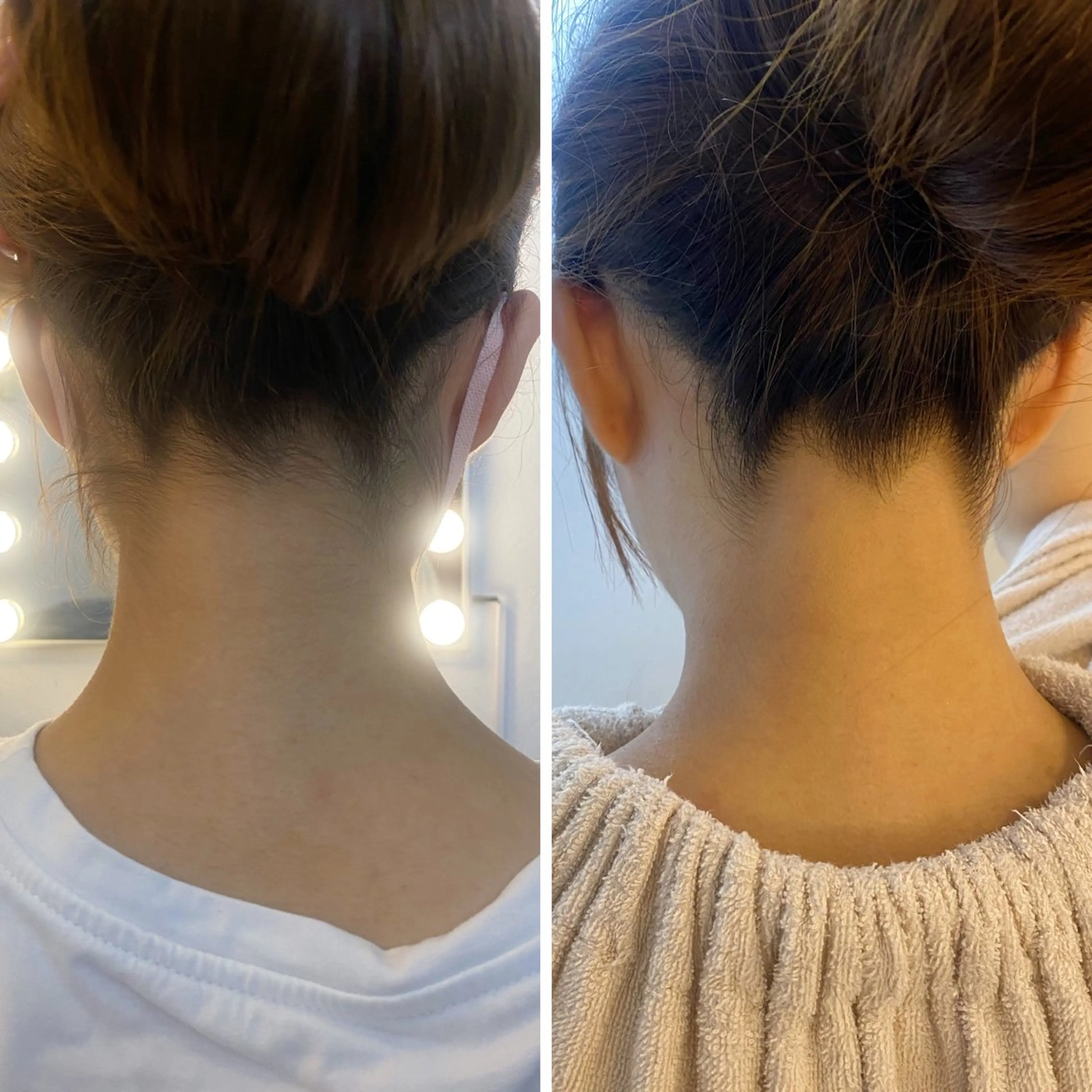 脱毛 うなじ脱毛/美肌脱毛 LABELのエステ・リラクイメージ