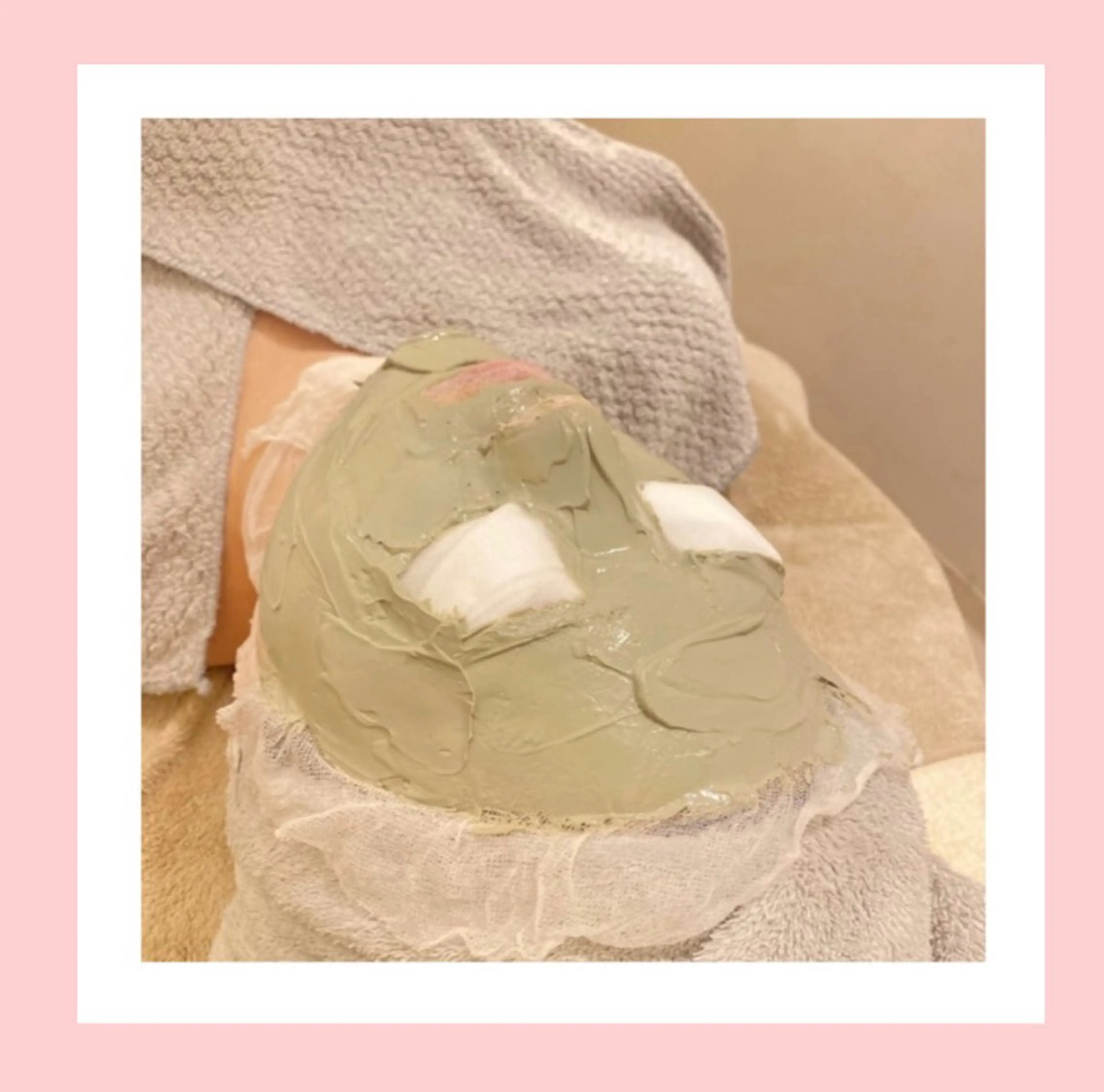 人気No.1💗 ̖́-【毛穴洗浄+肌質改善エステ】敏感・ニキビ・毛穴にお悩みの方の写真