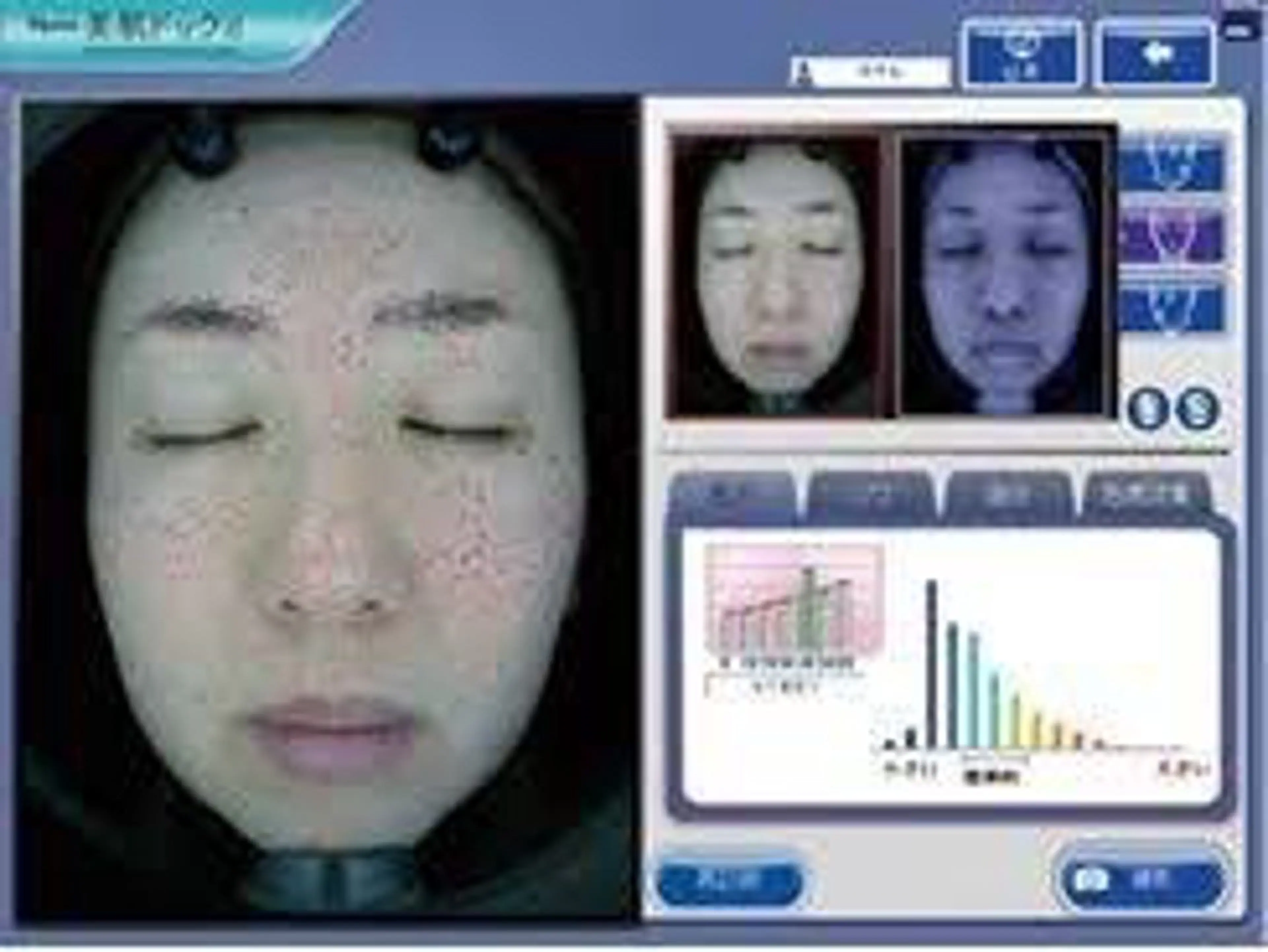 美肌ドック(お肌診断)の写真