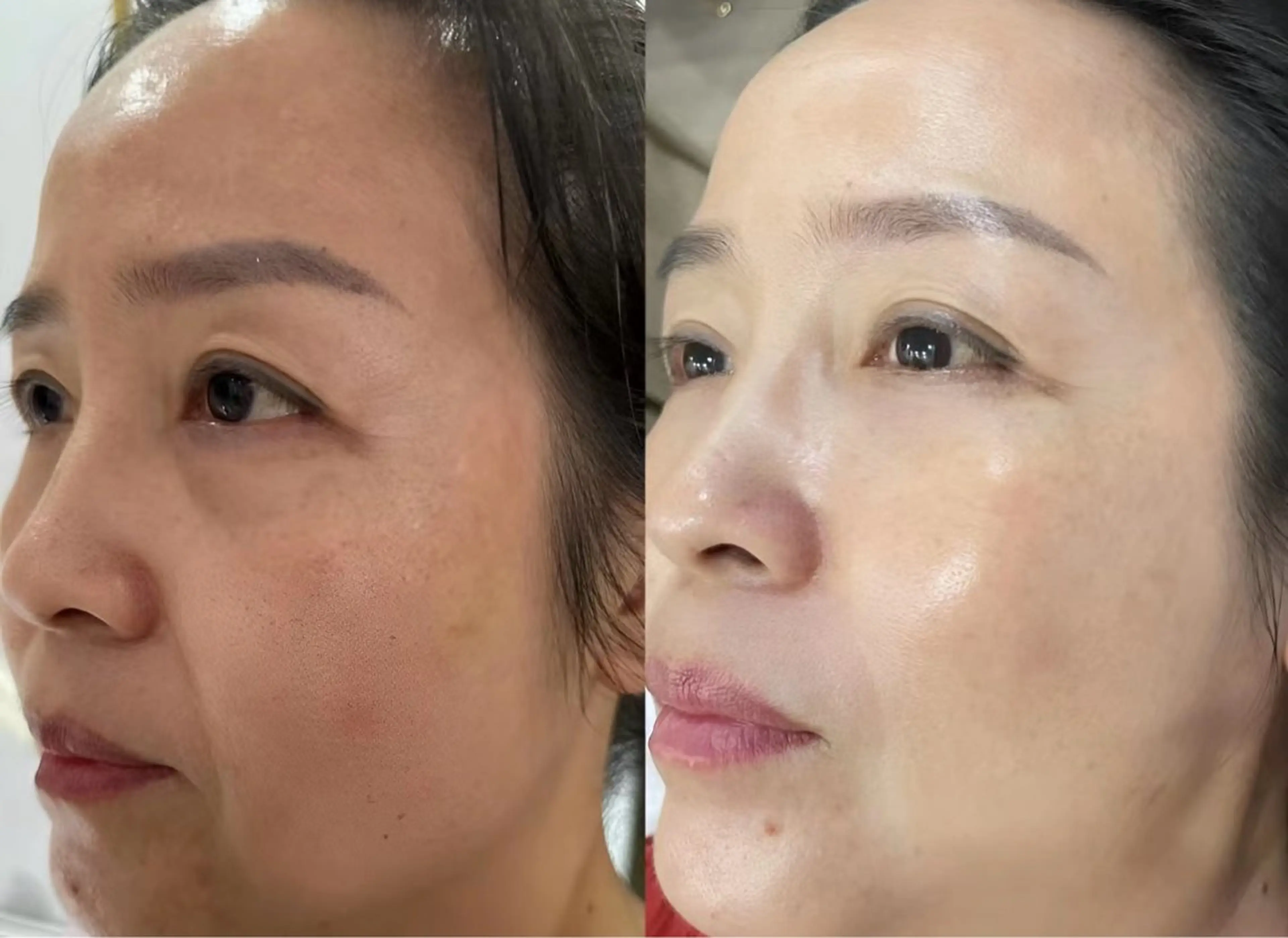 ネイル エステ aliaハイフ&水光ジェットサロン所属・aliaハーブ水光店 エステティシャン募集のエステ・リラクイメージ