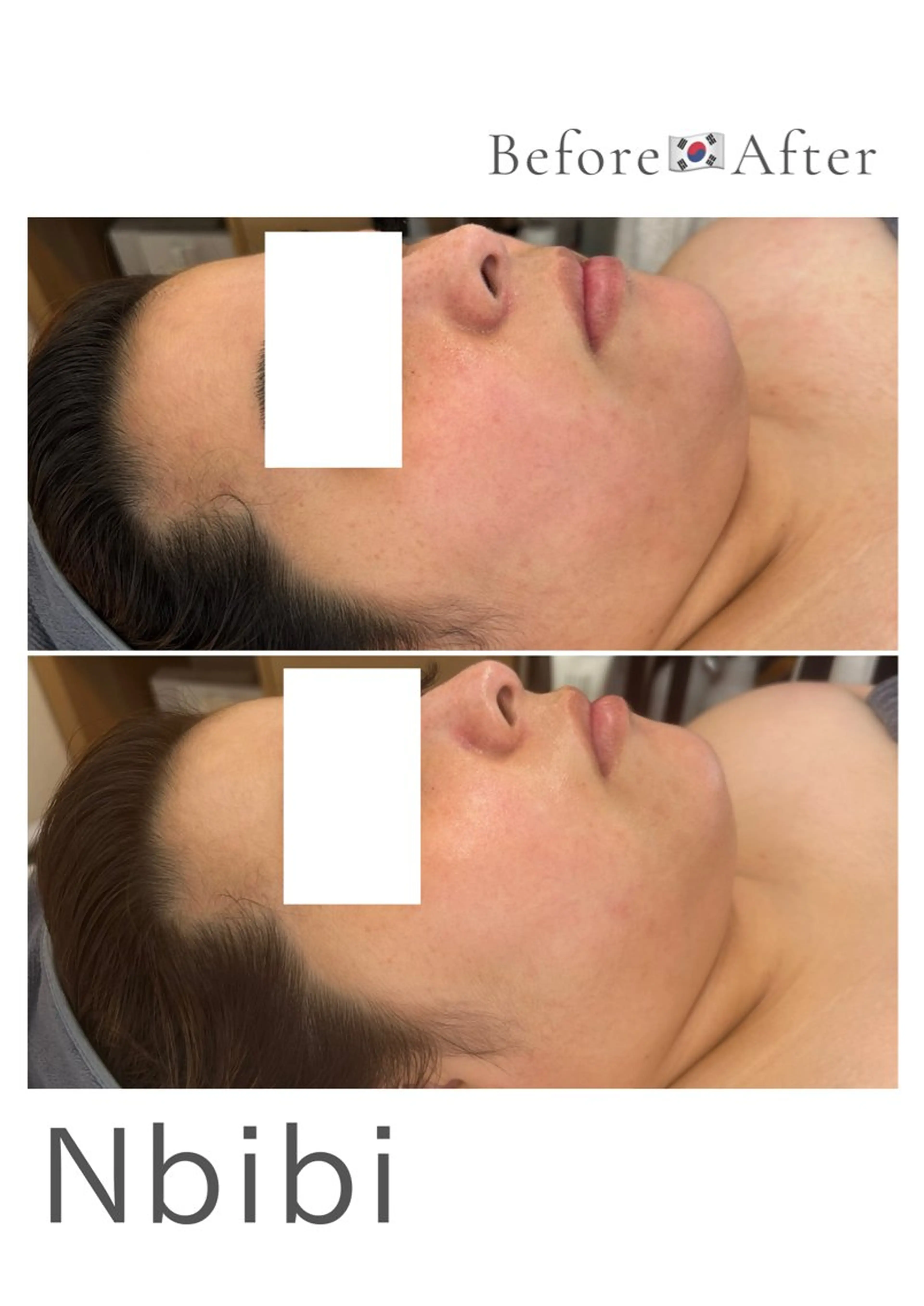 韓国🇰🇷価格 サロン_Nbibiのエステ・リラクイメージ