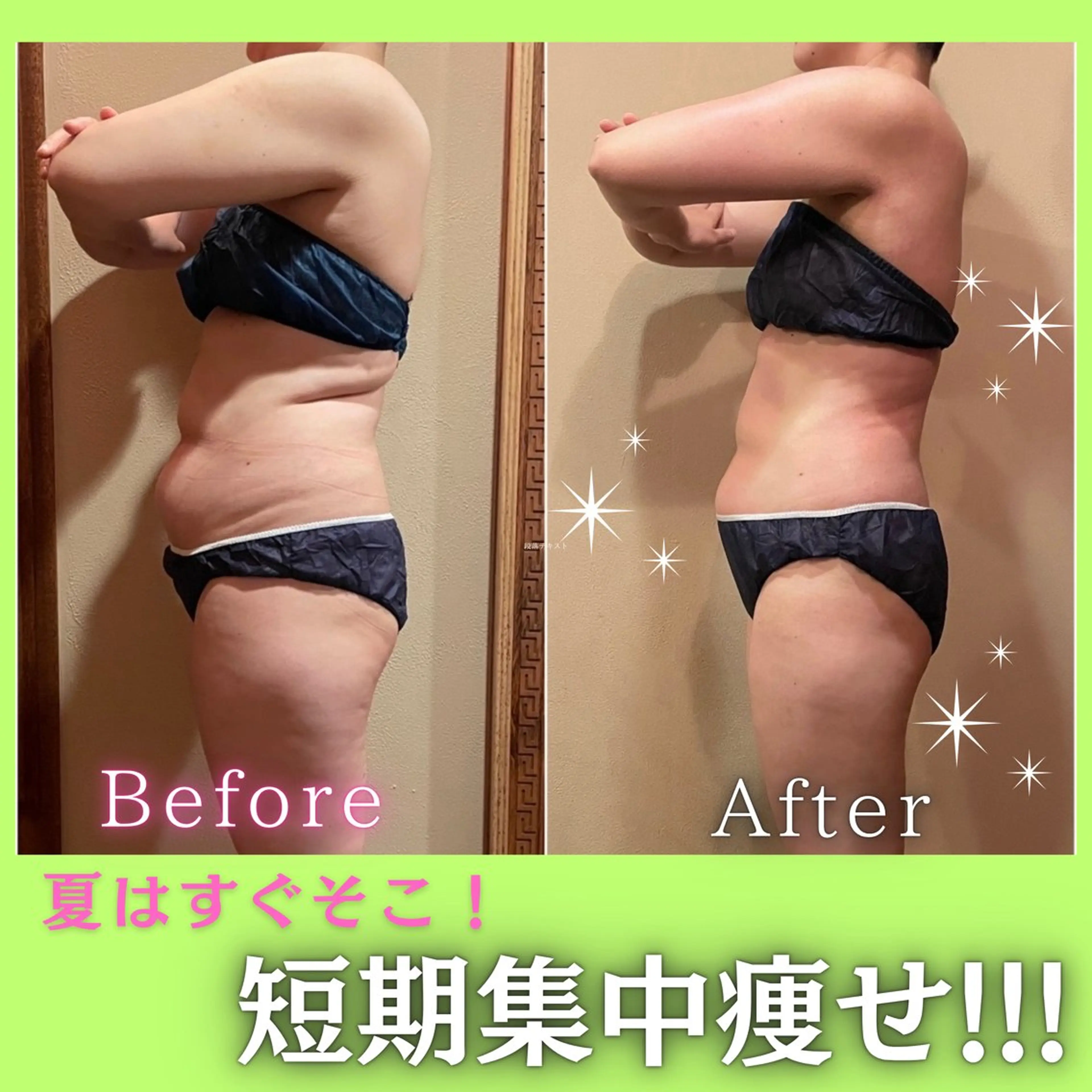 新機械導入❤️‍🔥人気NO.1💆‍♀️4STEPでお腹徹底痩身!!! ビュースタオリジナルの最強メソッド⸝⋆の写真