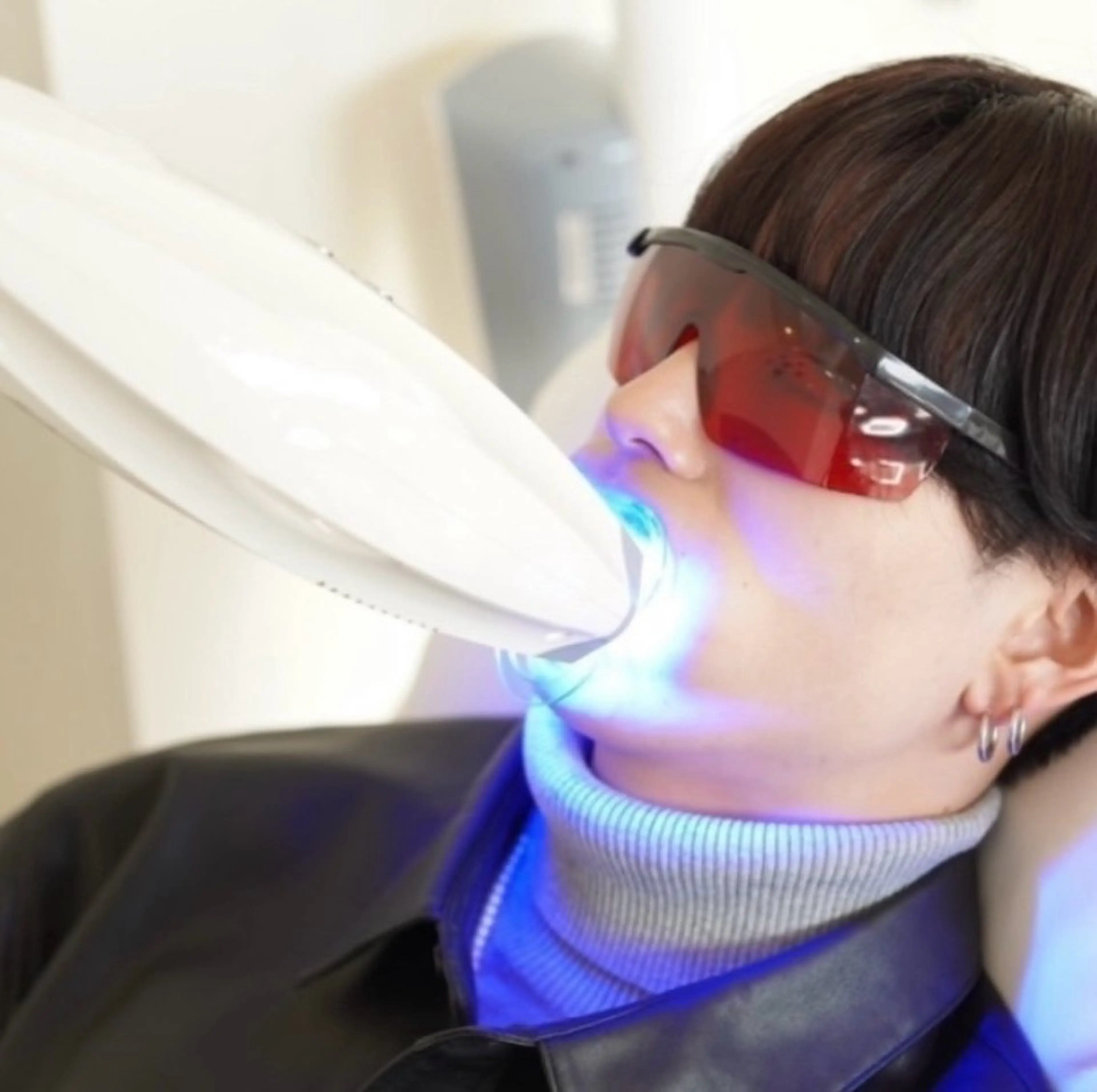 セルフホワイトニング【10分照射】➕脱毛無料体験チケット付き🎁の写真