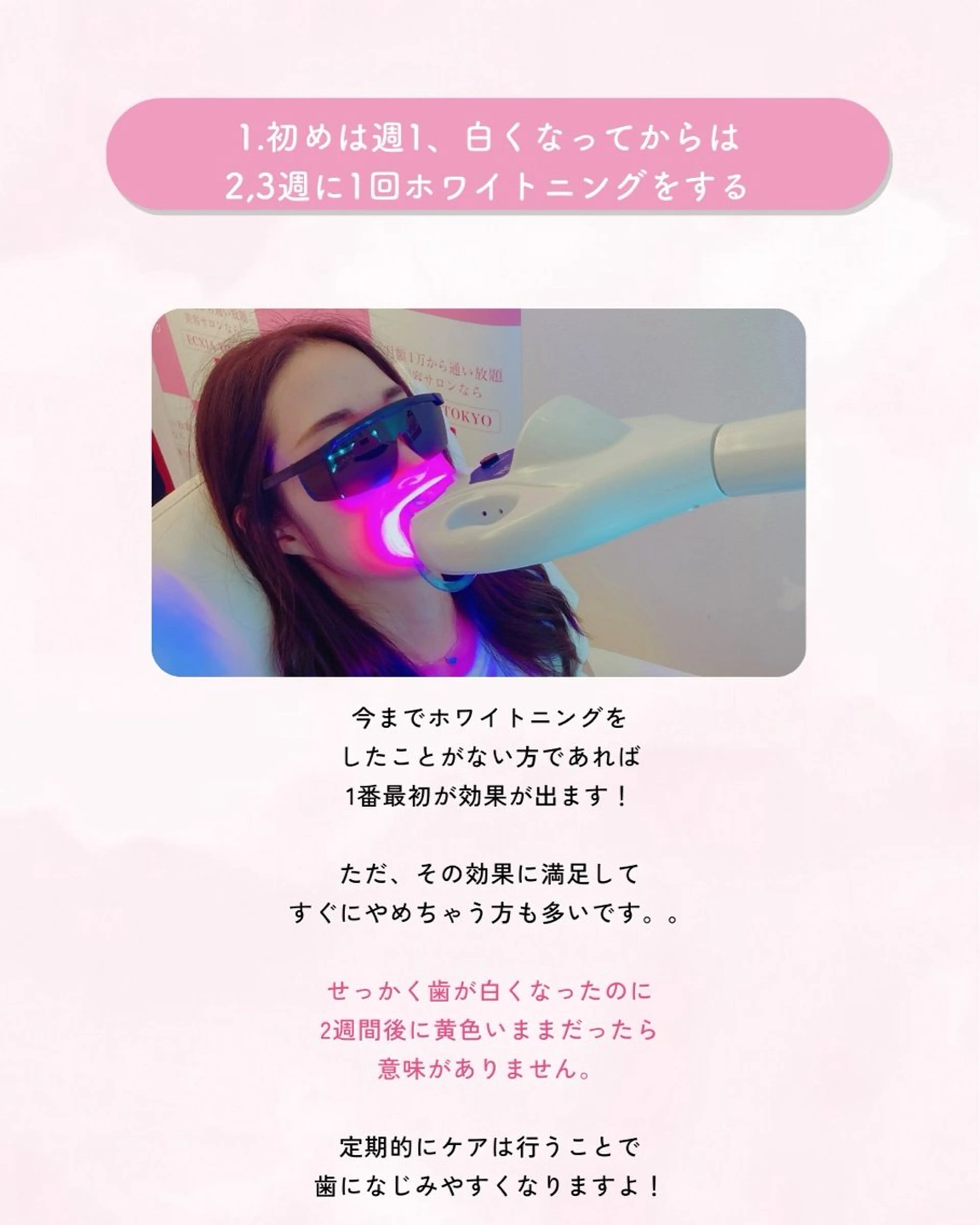 セルフホワイトニング エクシア大曽根店のその他イメージ