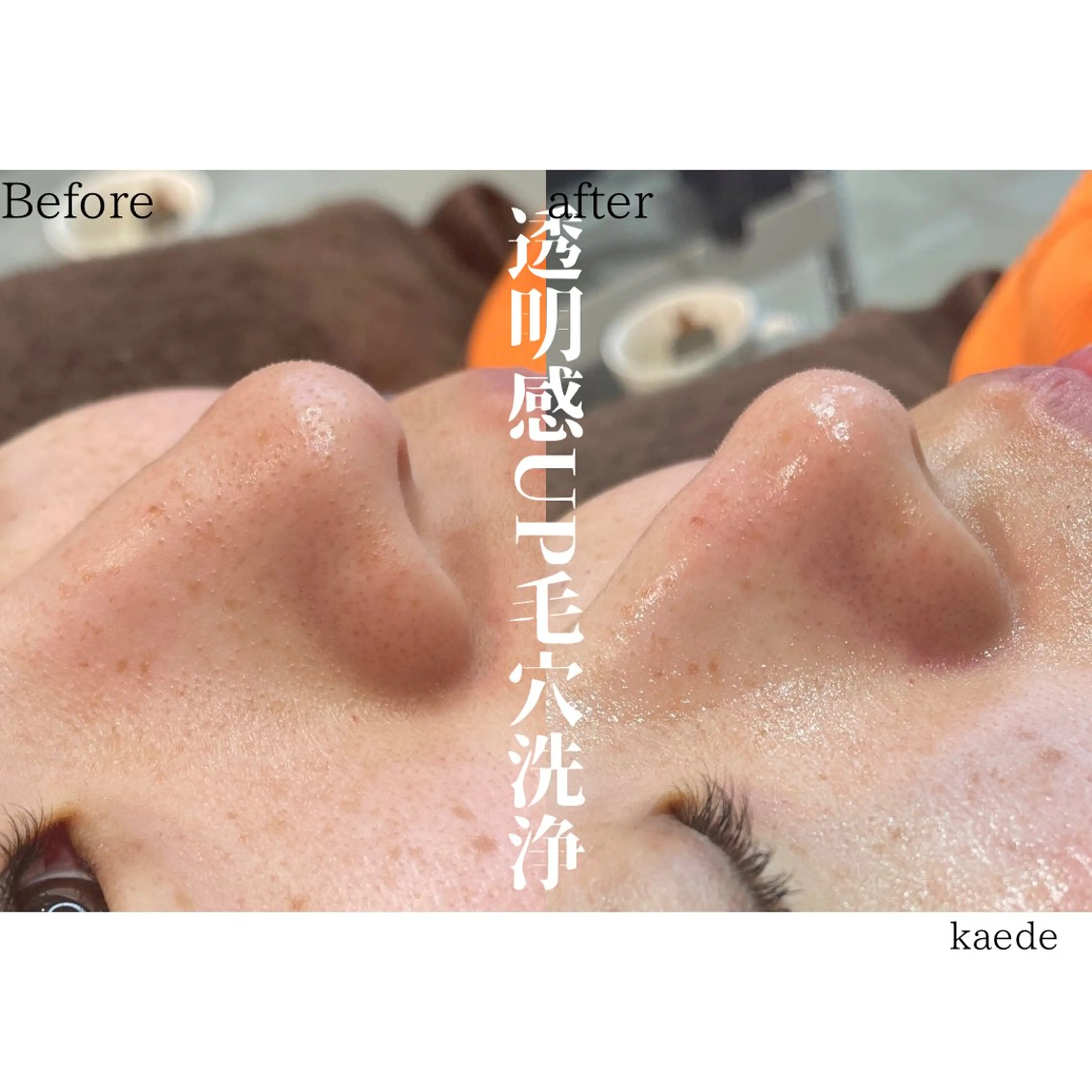 🎀kaede🎀 骨格似合わせ眉毛の眉毛・アイブロウイメージ