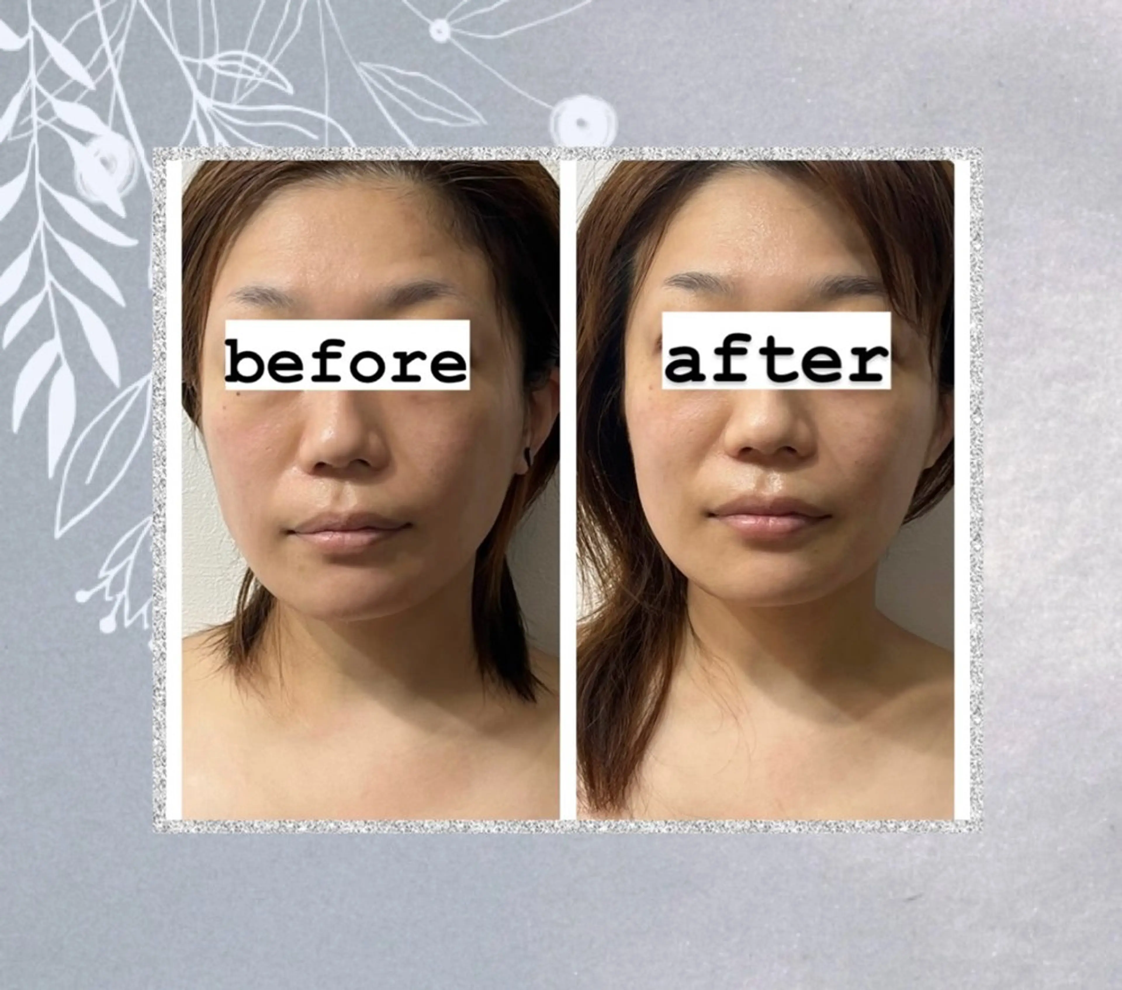 頭蓋骨小顔矯正💀お顔悩み根本解決65分の写真