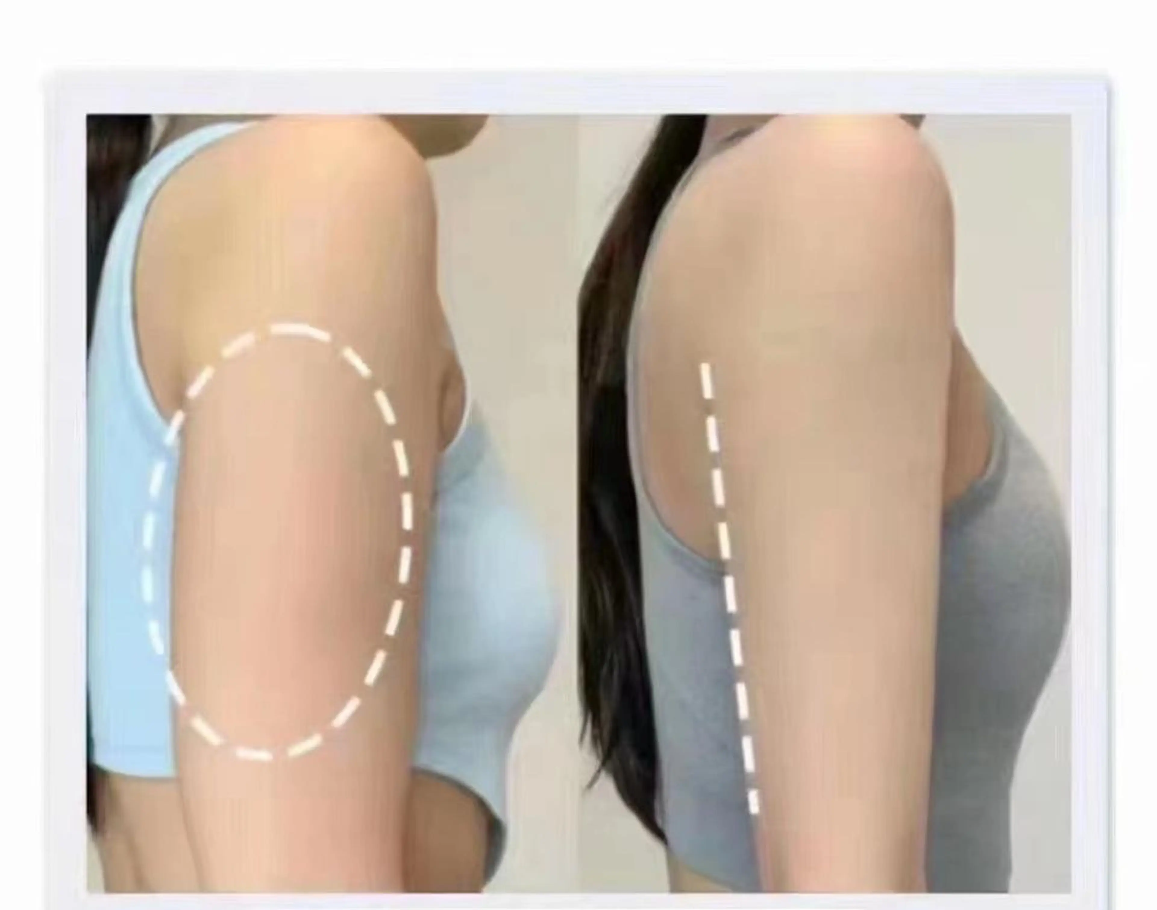 エステ リラク aliaハイフ&水光ジェットサロン所属・aliaハーブ水光店 エステティシャン募集のエステ・リラクイメージ