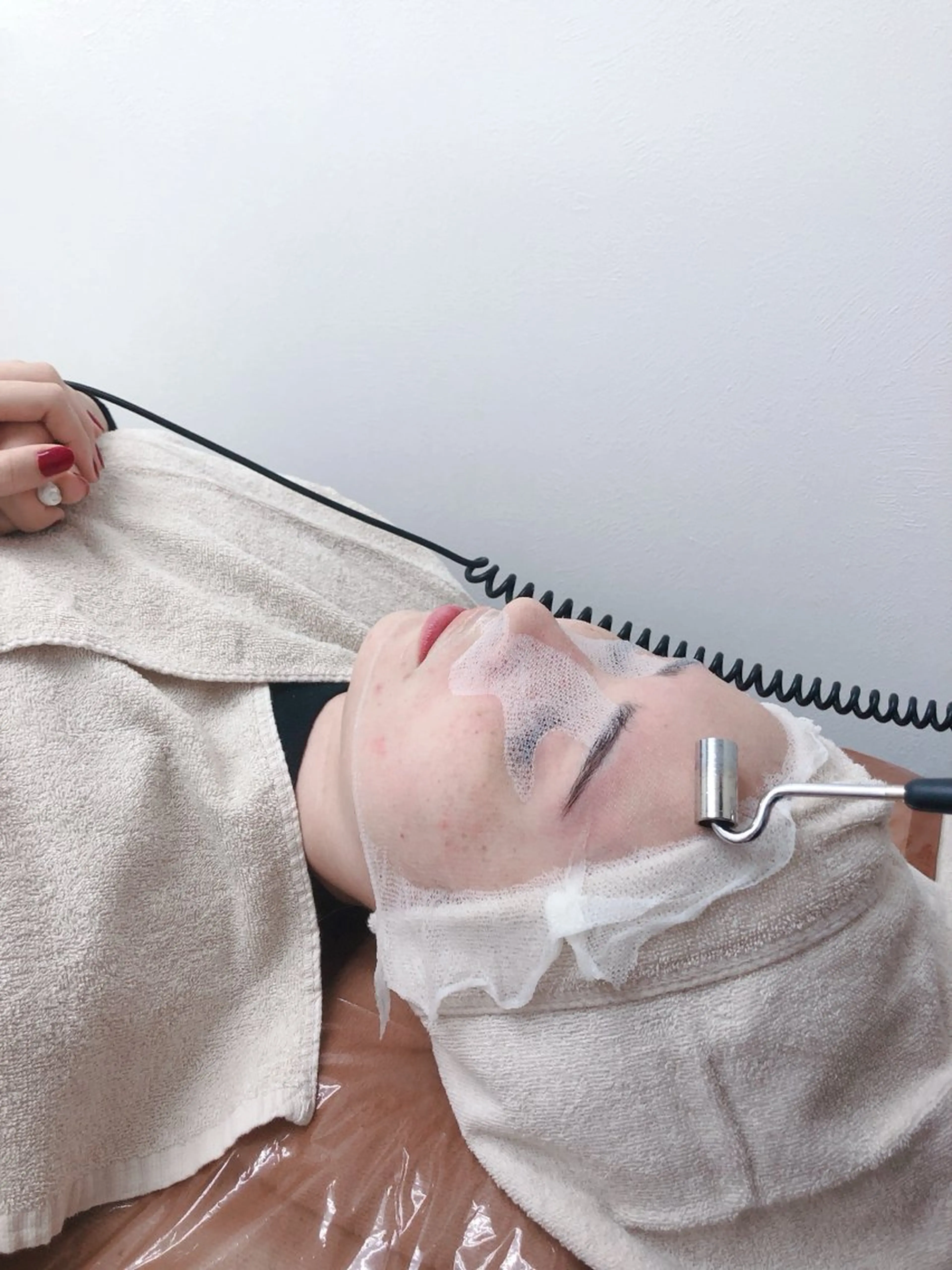 美白🌼ニキビ跡に！ビタミンCイオン導入🍋 最新ハイブリッド脱毛チケット付き※全身全顔からパーツを選べる✨の写真