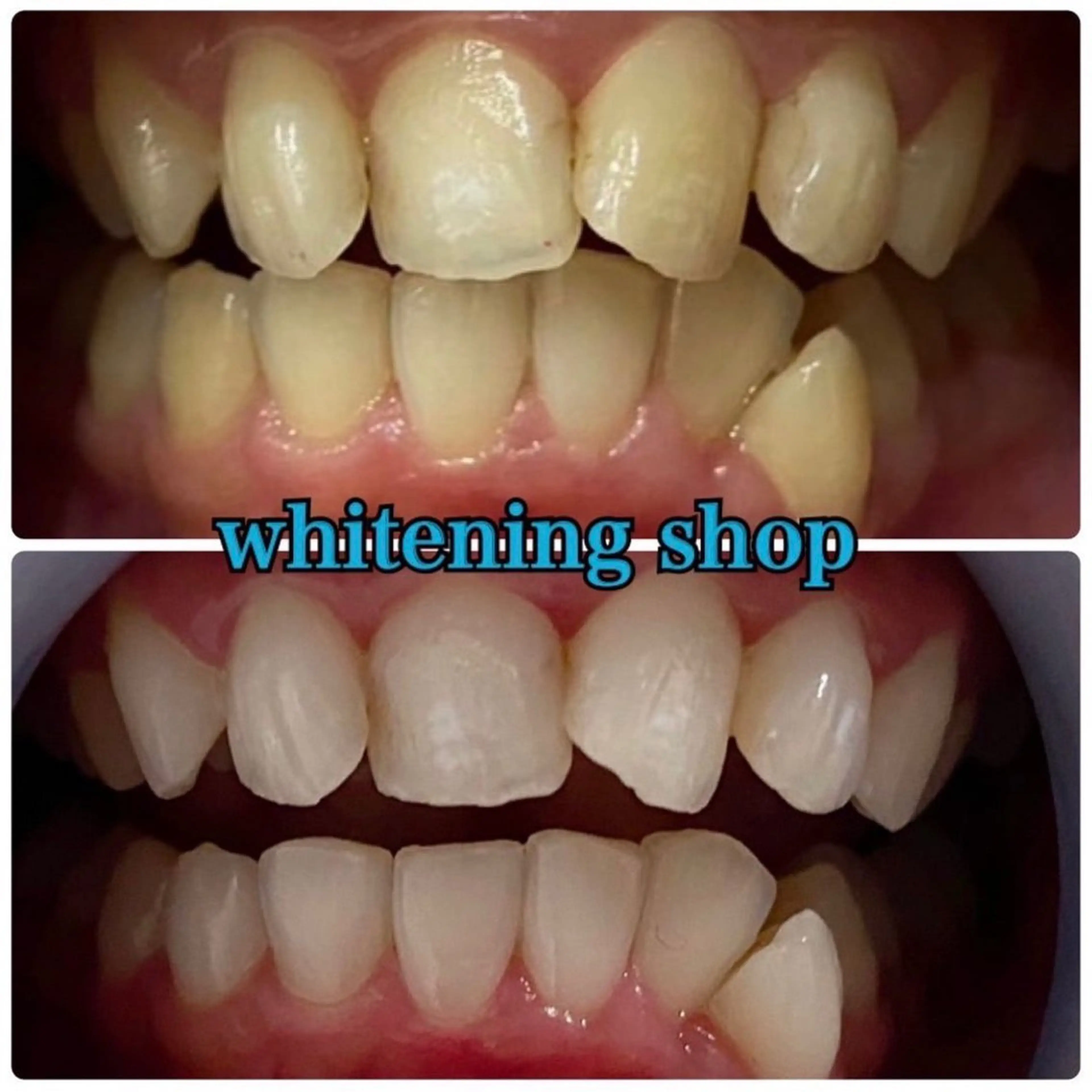 エステ リラク ホワイトニング ショップ吉祥寺店のエステ・リラクイメージ