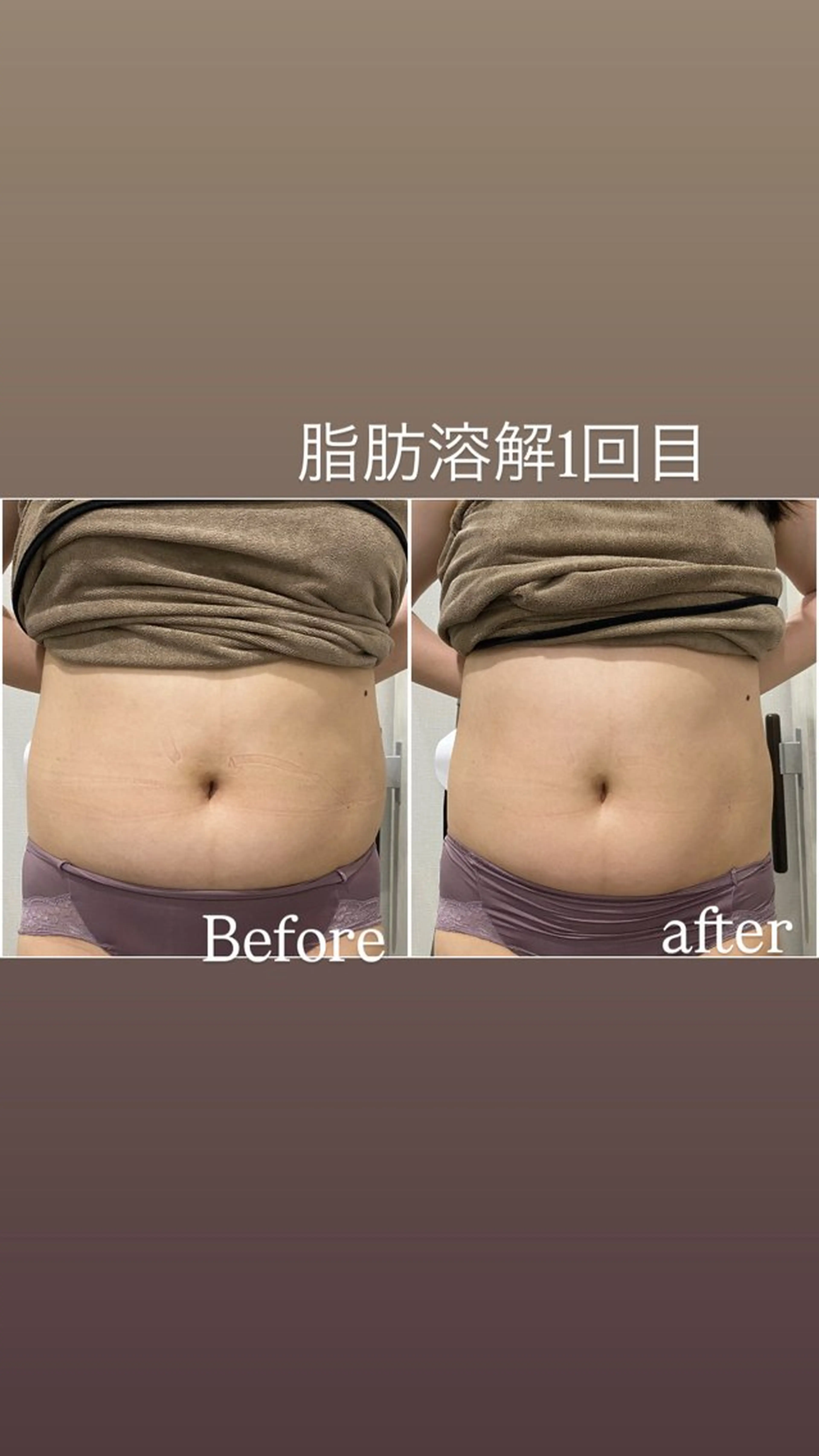 エステ 毛穴洗浄・痩身・脱毛 /アルカンジュのエステ・リラクイメージ