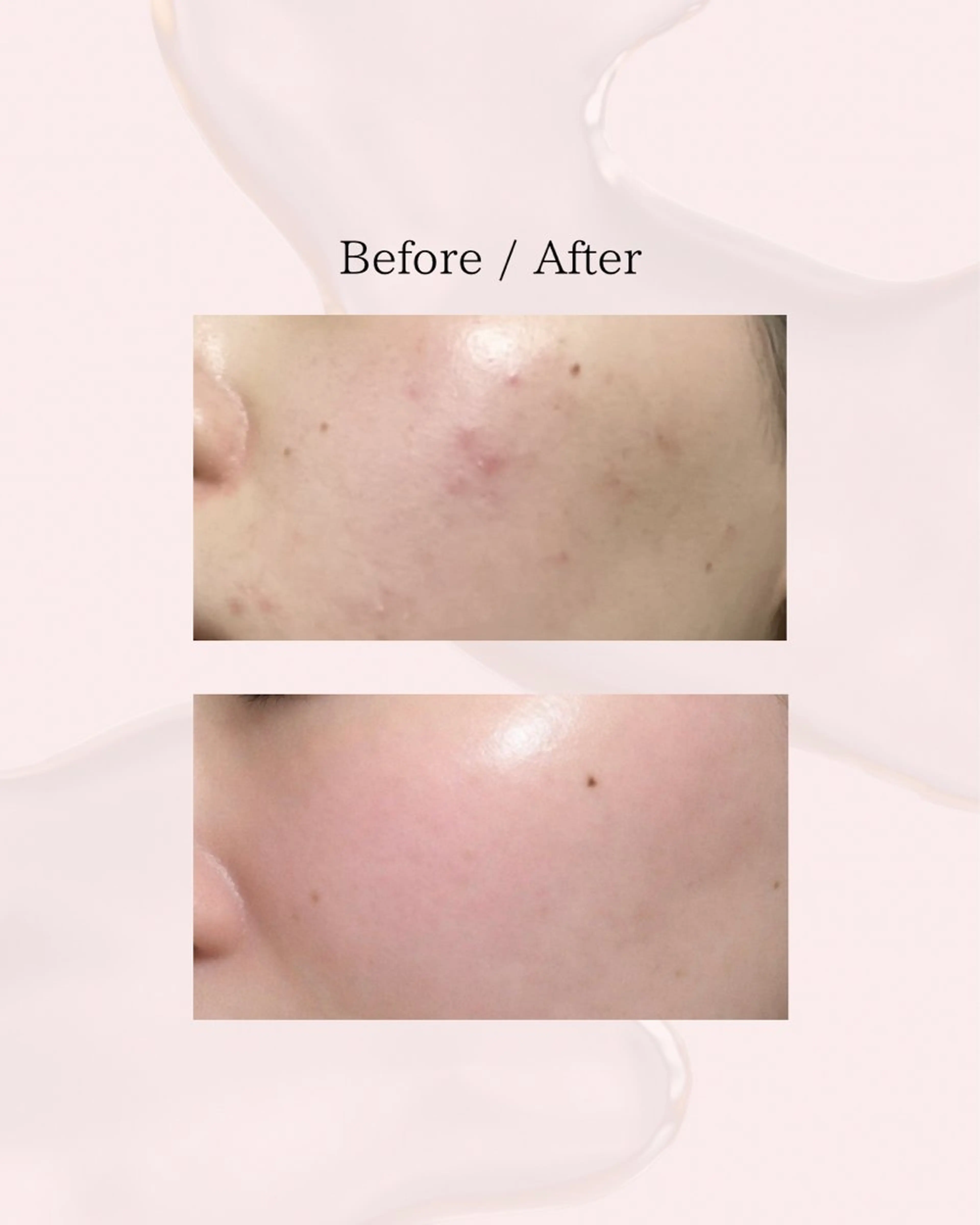 エステ myherb所属・ニキビ肌改善サロン myherb🌿のエステ・リラクイメージ