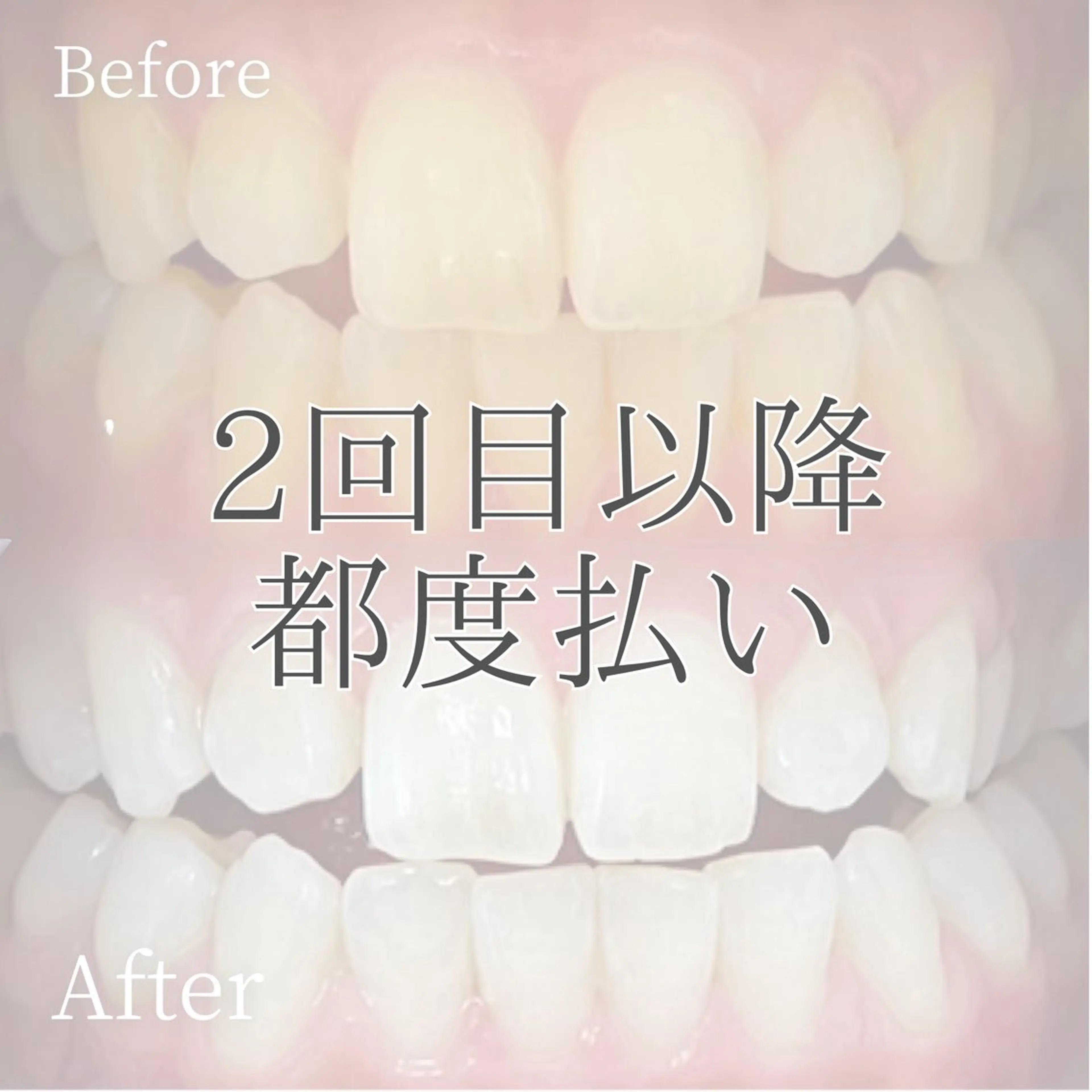 メンズ キッズ その他 ホワイトニング ショップ多摩店のその他イメージ