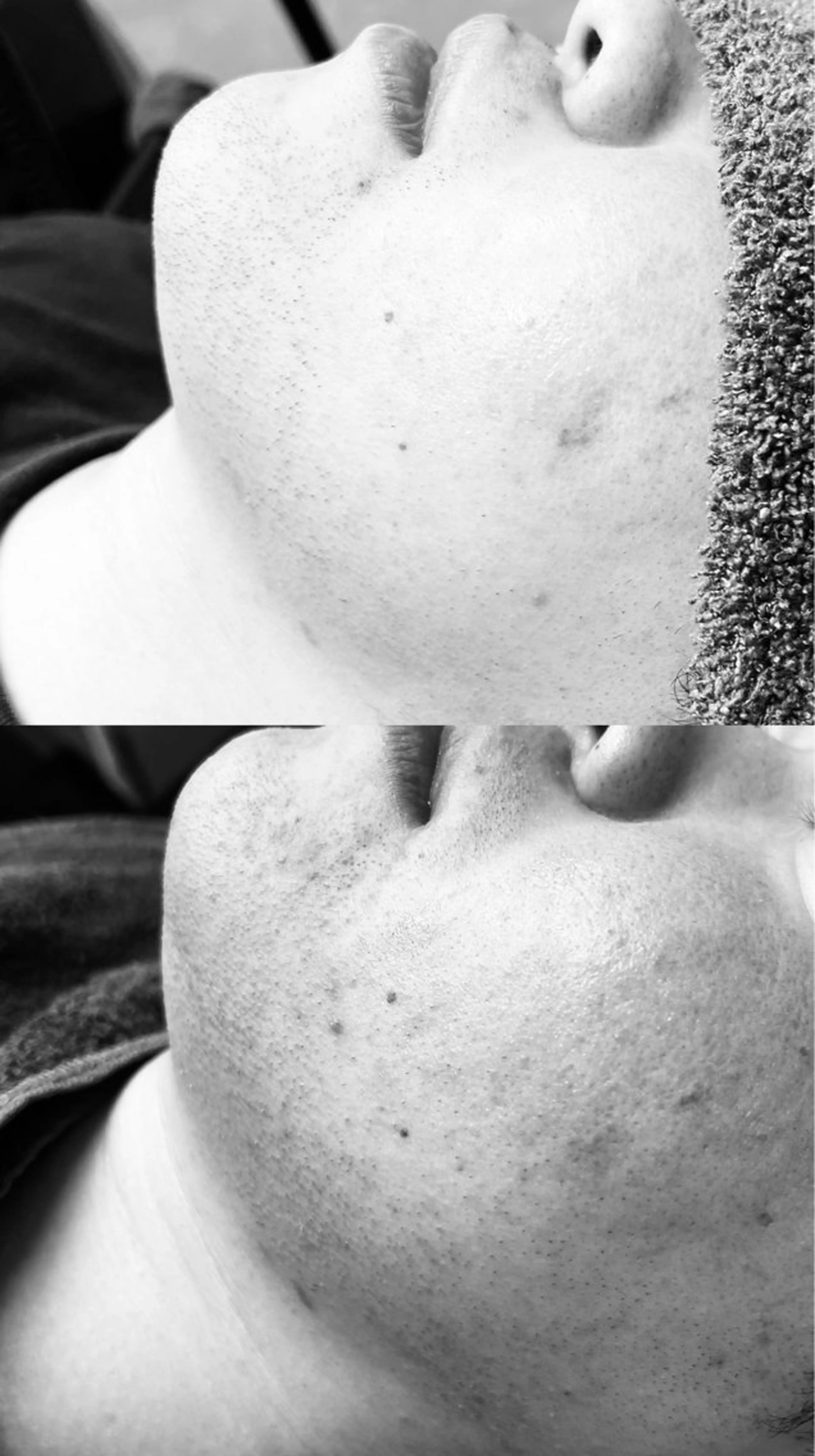 脱毛 エステサロンTug高知駅前店所属・Tug 高知駅前店/ NANAMI🌐のエステ・リラクイメージ