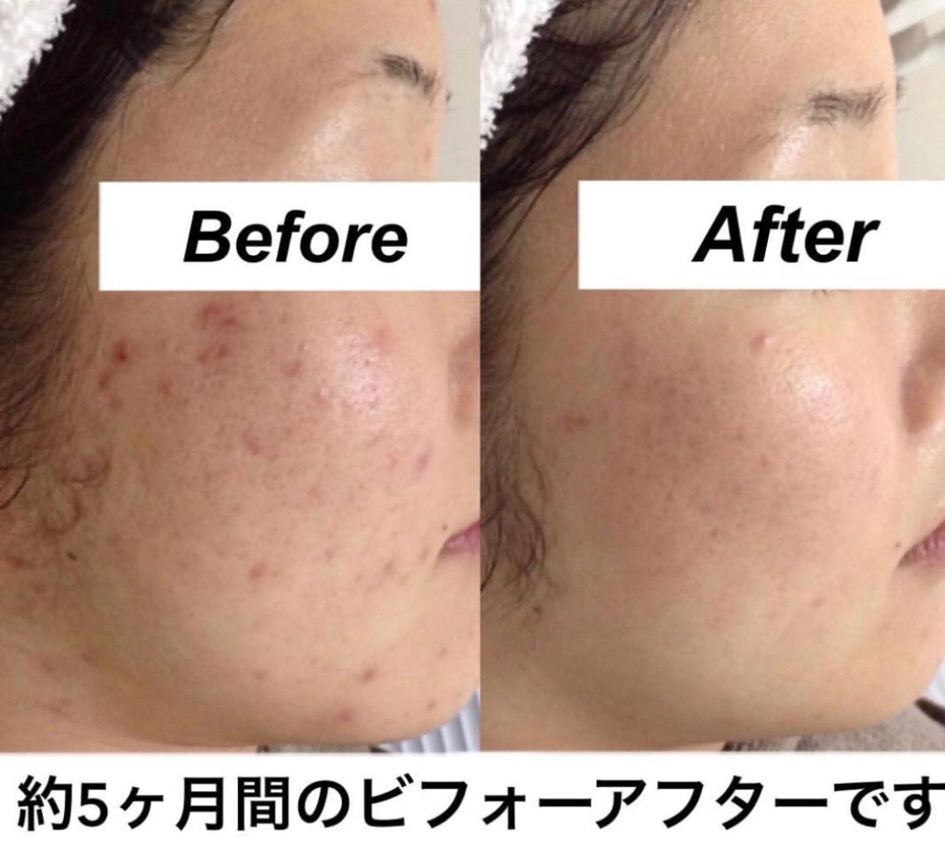 エステ リラク 都度払い肌質改善 &脱毛Blancheのエステ・リラクイメージ