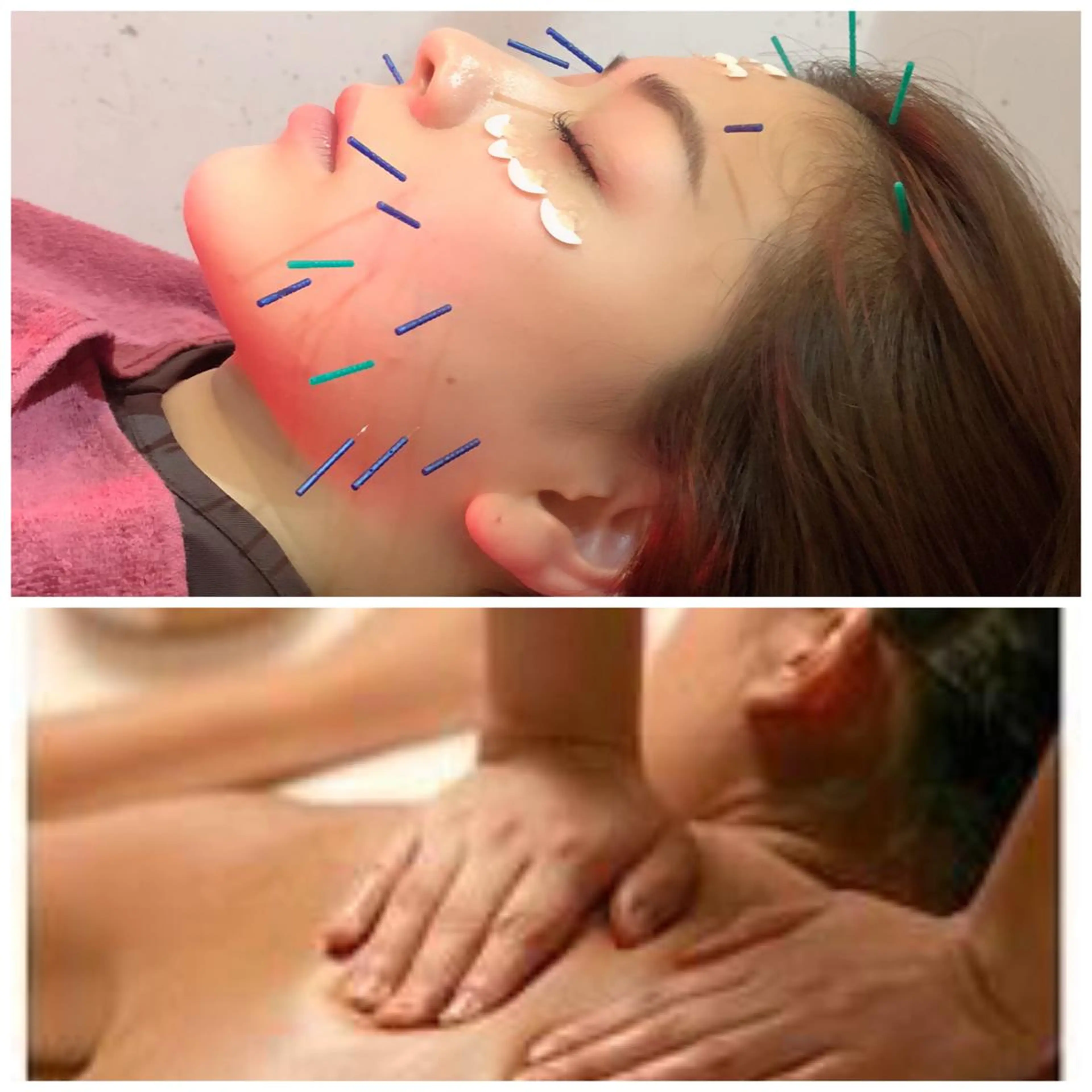 美容鍼灸女性専用 りんご鍼灸治療院のエステ・リラクイメージ