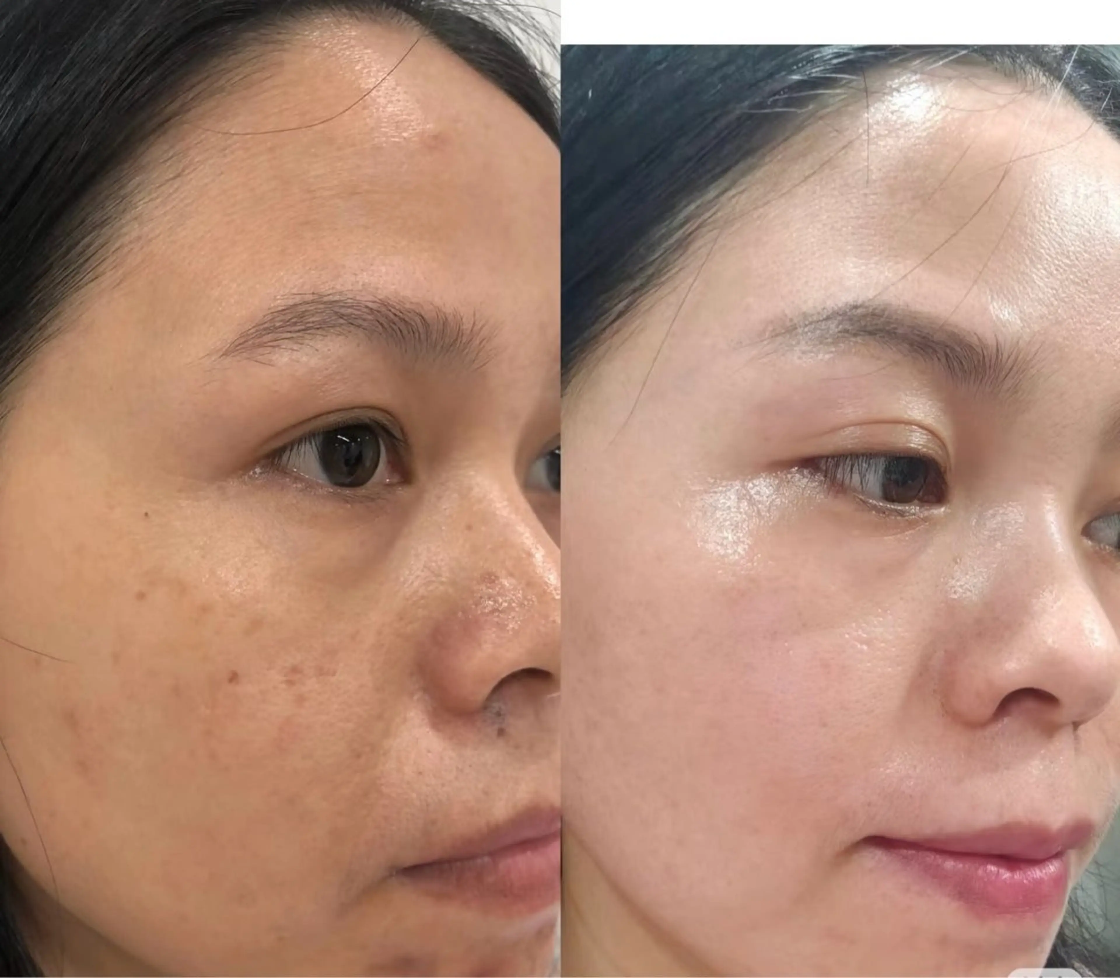 パーマ エステ aliaハイフ&水光ジェットサロン所属・aliaハーブ水光店 エステティシャン募集のエステ・リラクイメージ