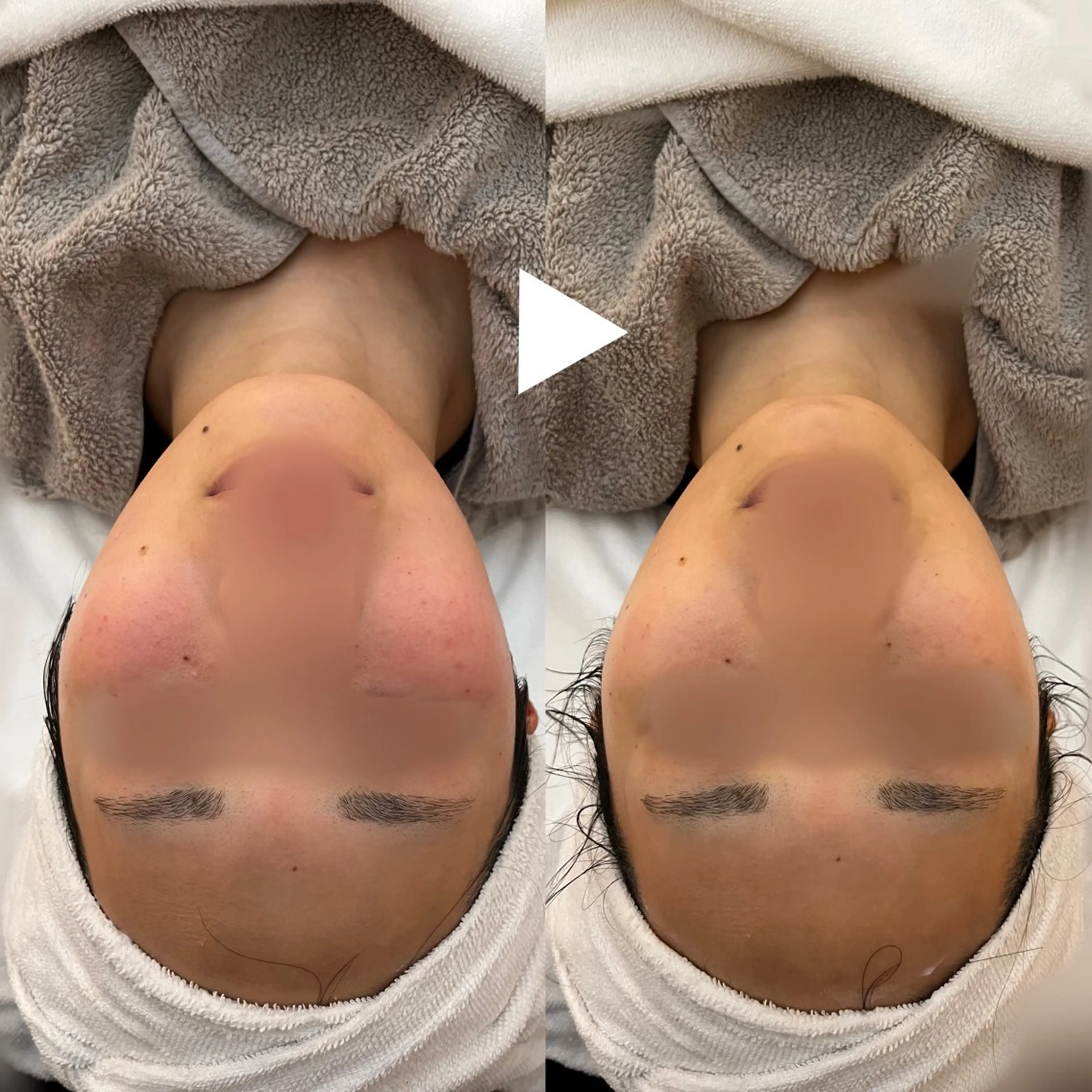 エステ 肌質改善サロン🌕 ⠀【ルーナピエナ】のエステ・リラクイメージ