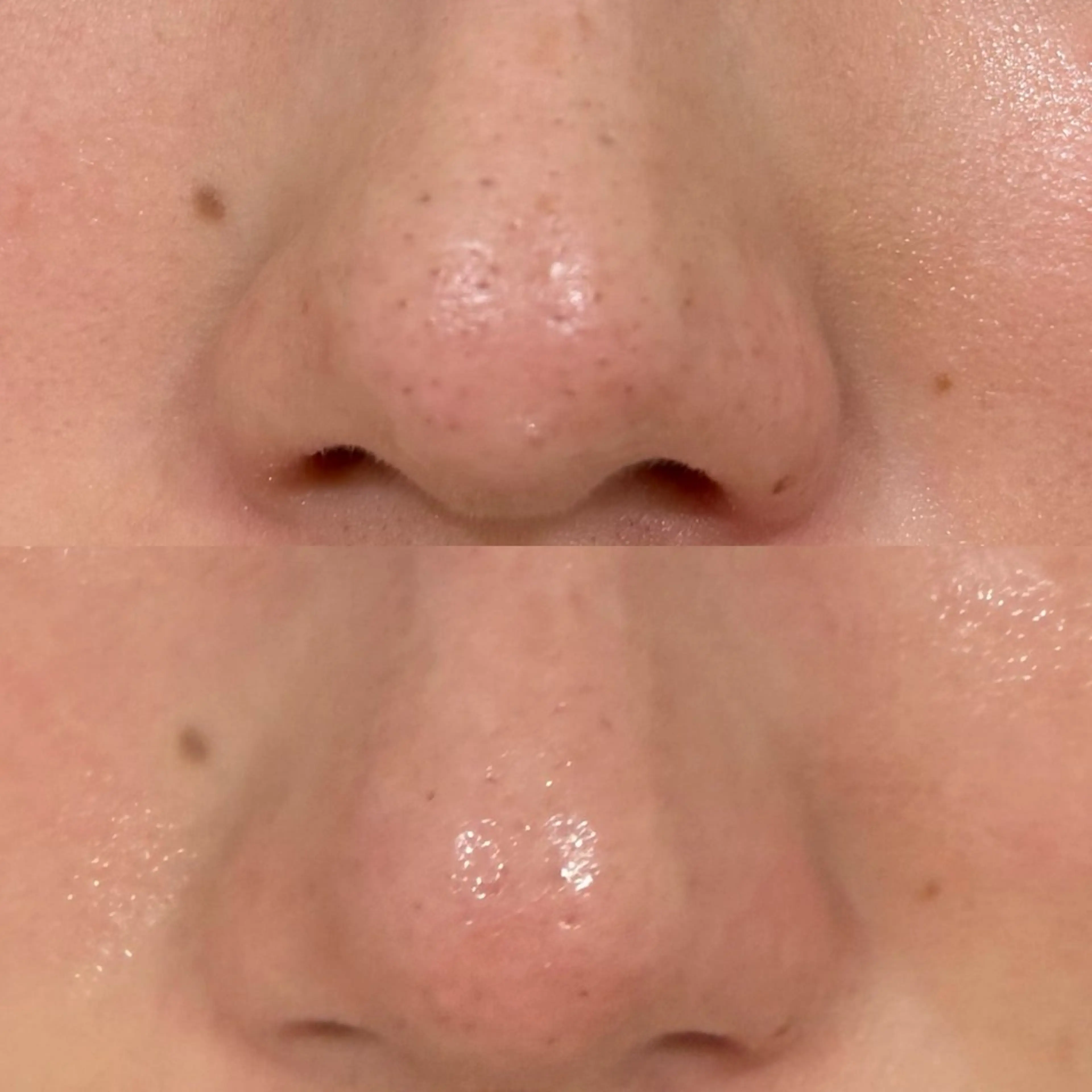 エステ vary  clue MISAのエステ・リラクイメージ